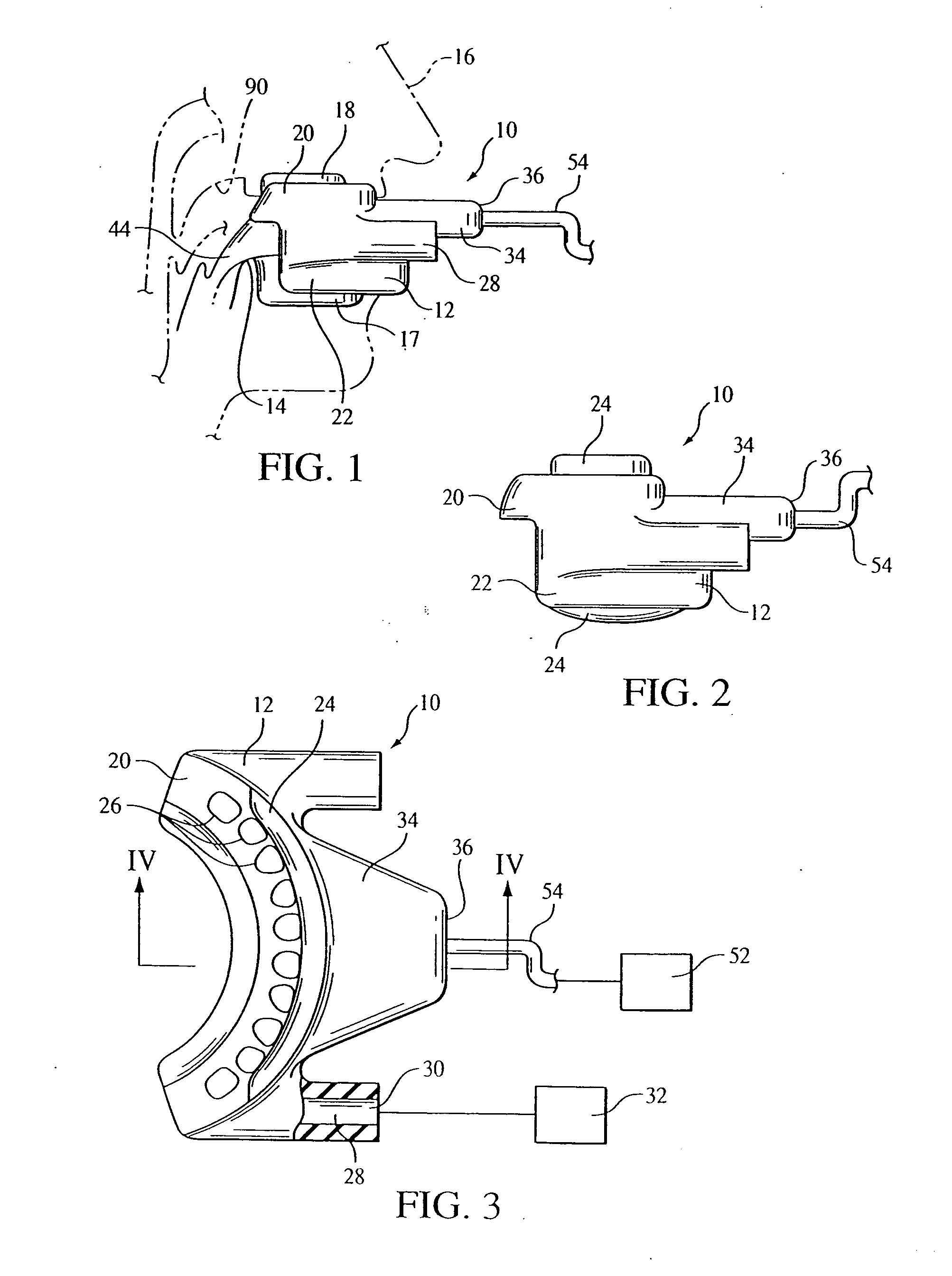 Intraoral apparatus for enhancing airway patency