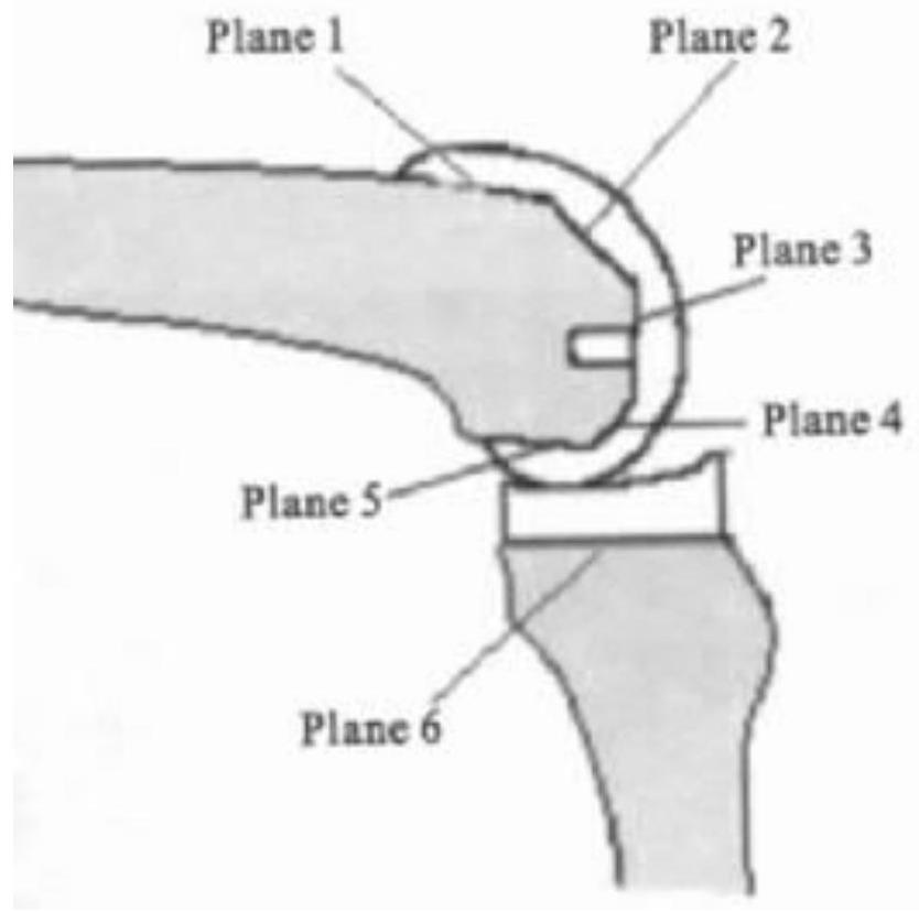 Knee joint gap measuring method and device, terminal equipment and readable storage medium