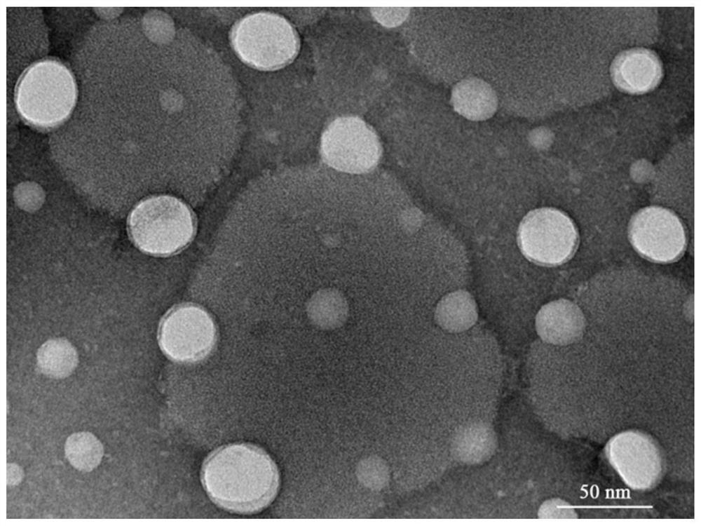 Chitosan lipoprotein nasal delivery nanocomposite as well as preparation method and application thereof