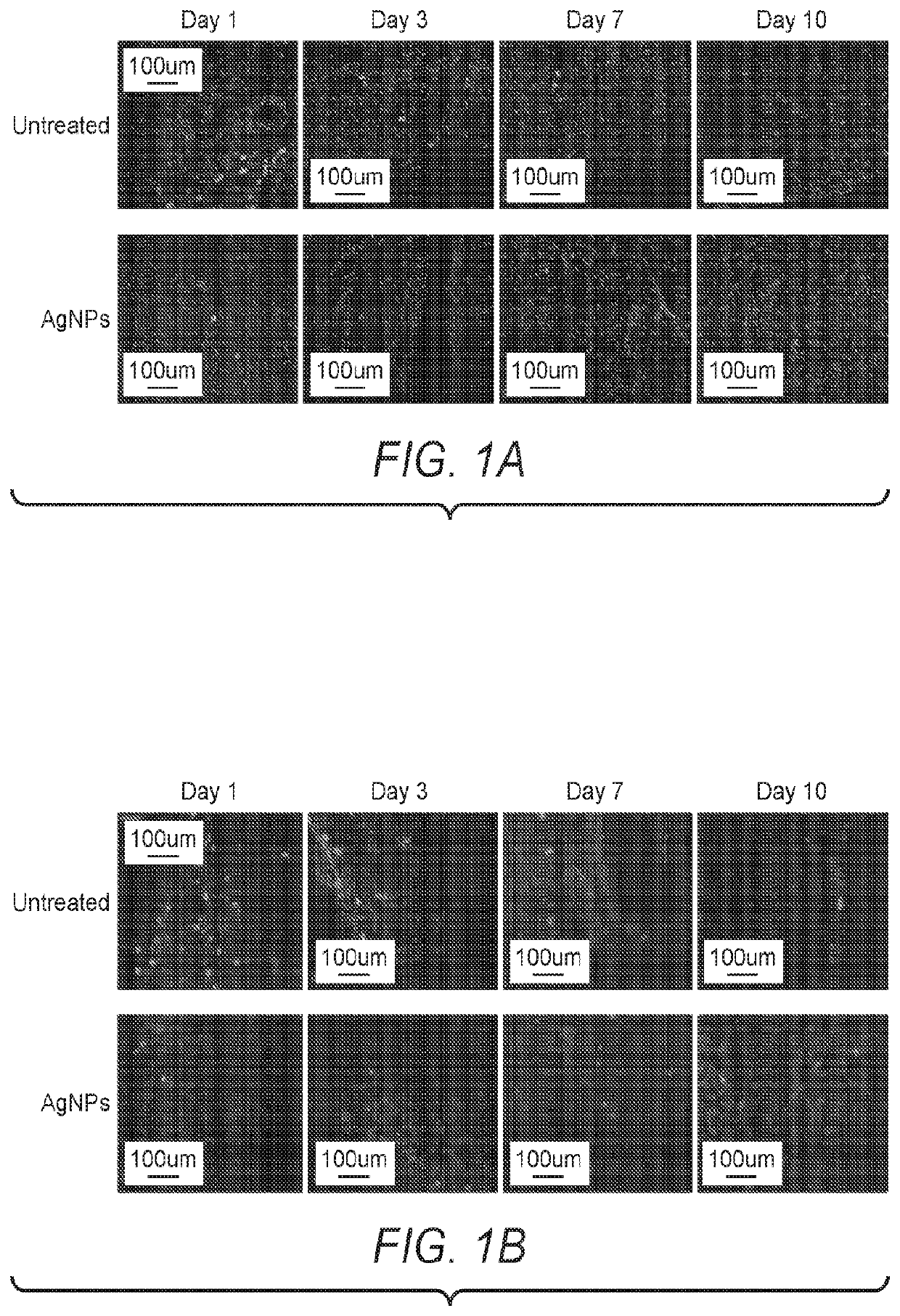 Compositions and methods for neuroprotection utilizing nanoparticulate silver