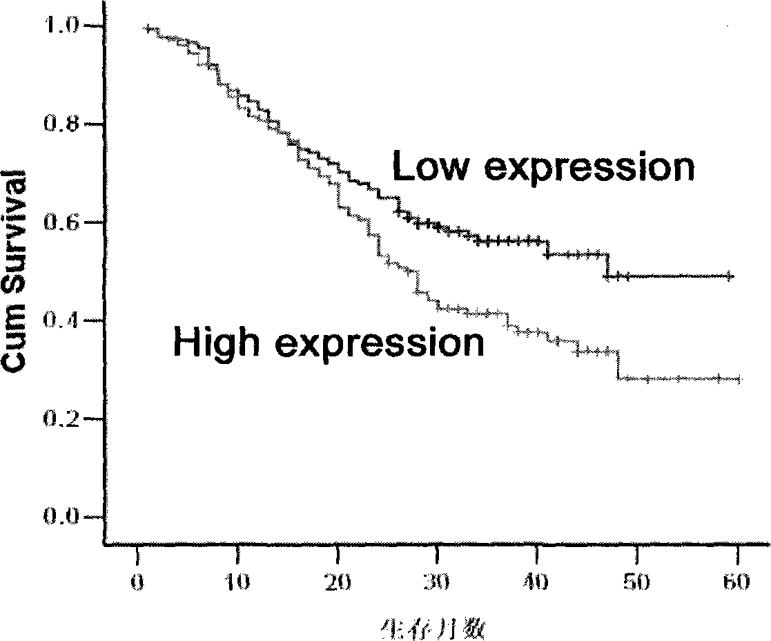 Kit for utilizing combination of four kinds of protein for predicting prognosis of esophagus cancer patient