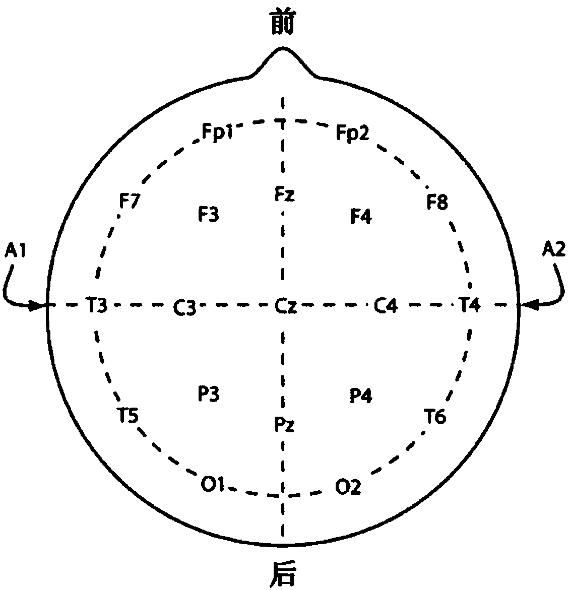 Device and method for positioning eeg or meg electrodes in brain mr images