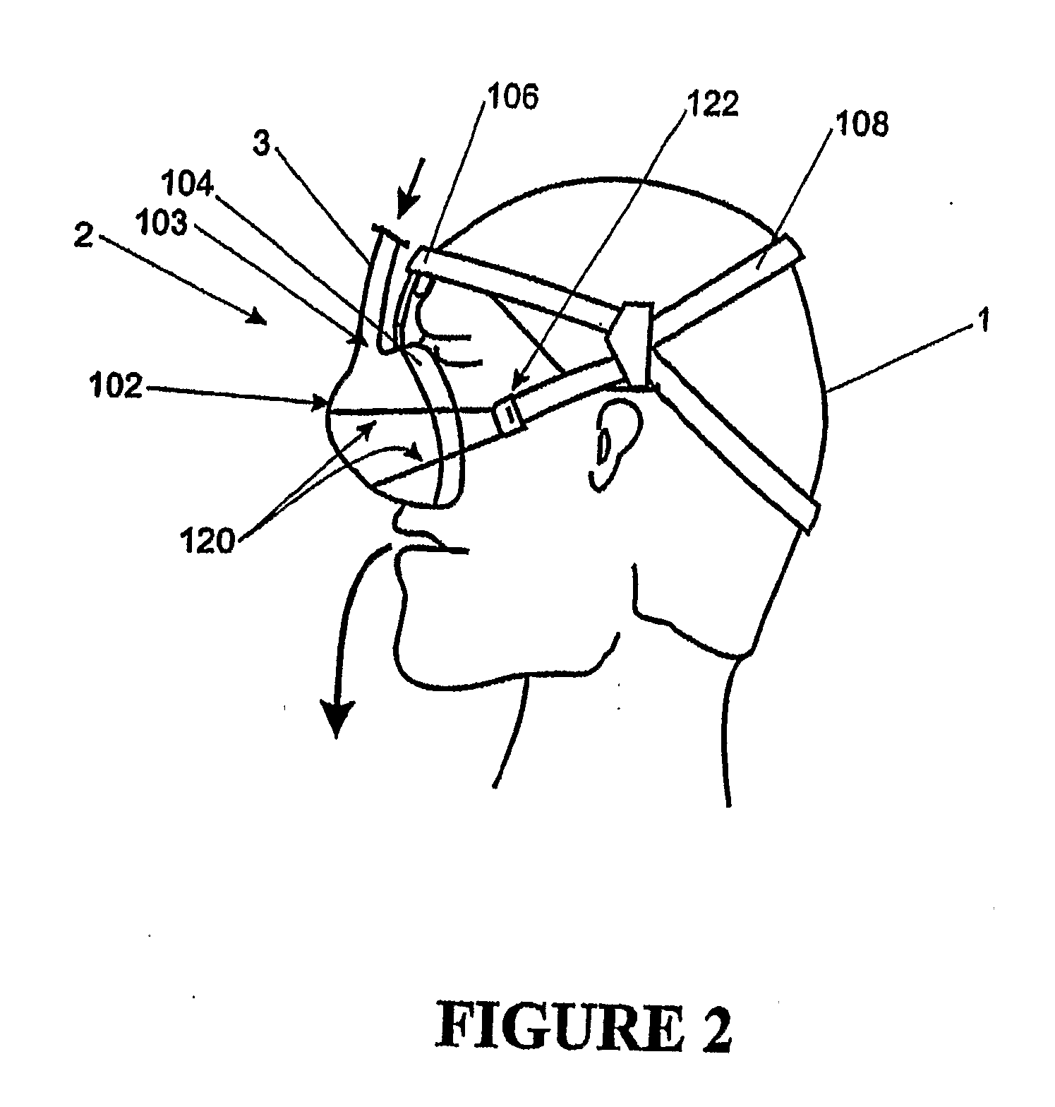 Breathing Assistance Apparatus