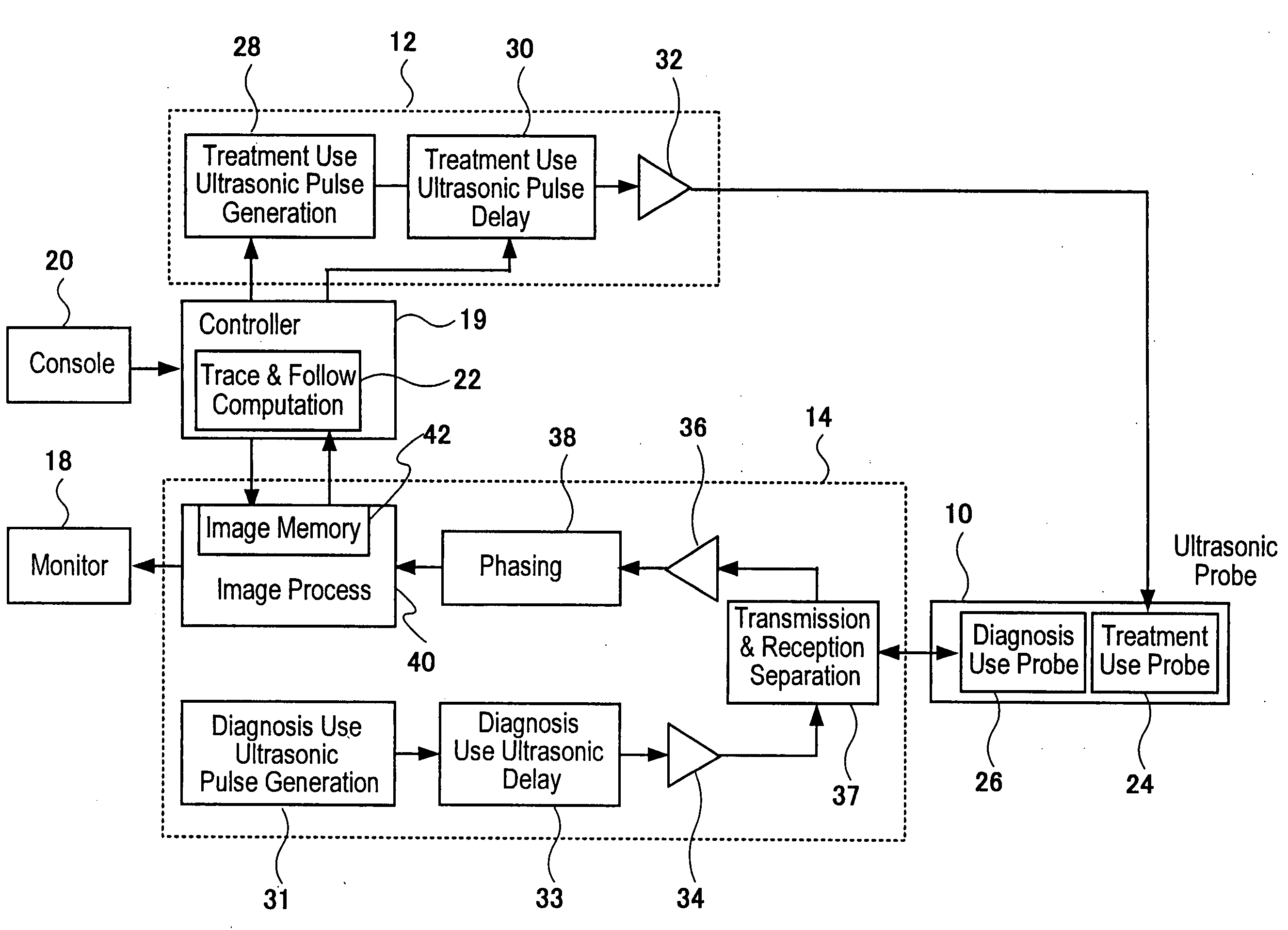 Ultrasonic Treatment Apparatus