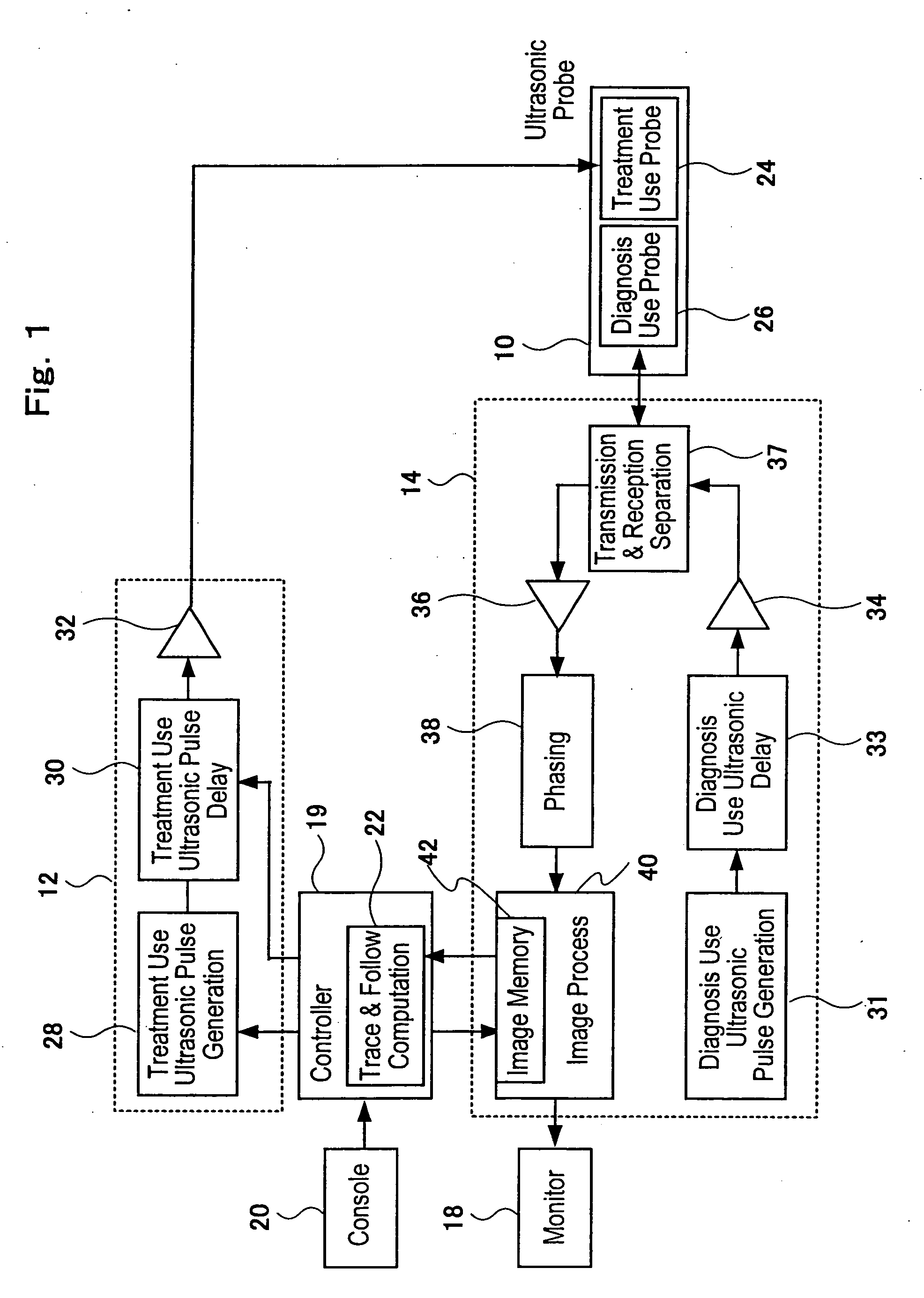 Ultrasonic Treatment Apparatus