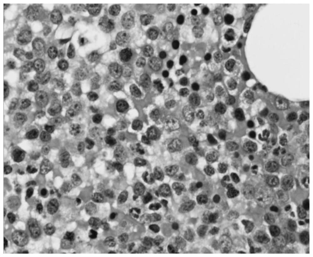 Myeloid tissue decalcification solution and method for preparing myeloid tissue paraffin sections