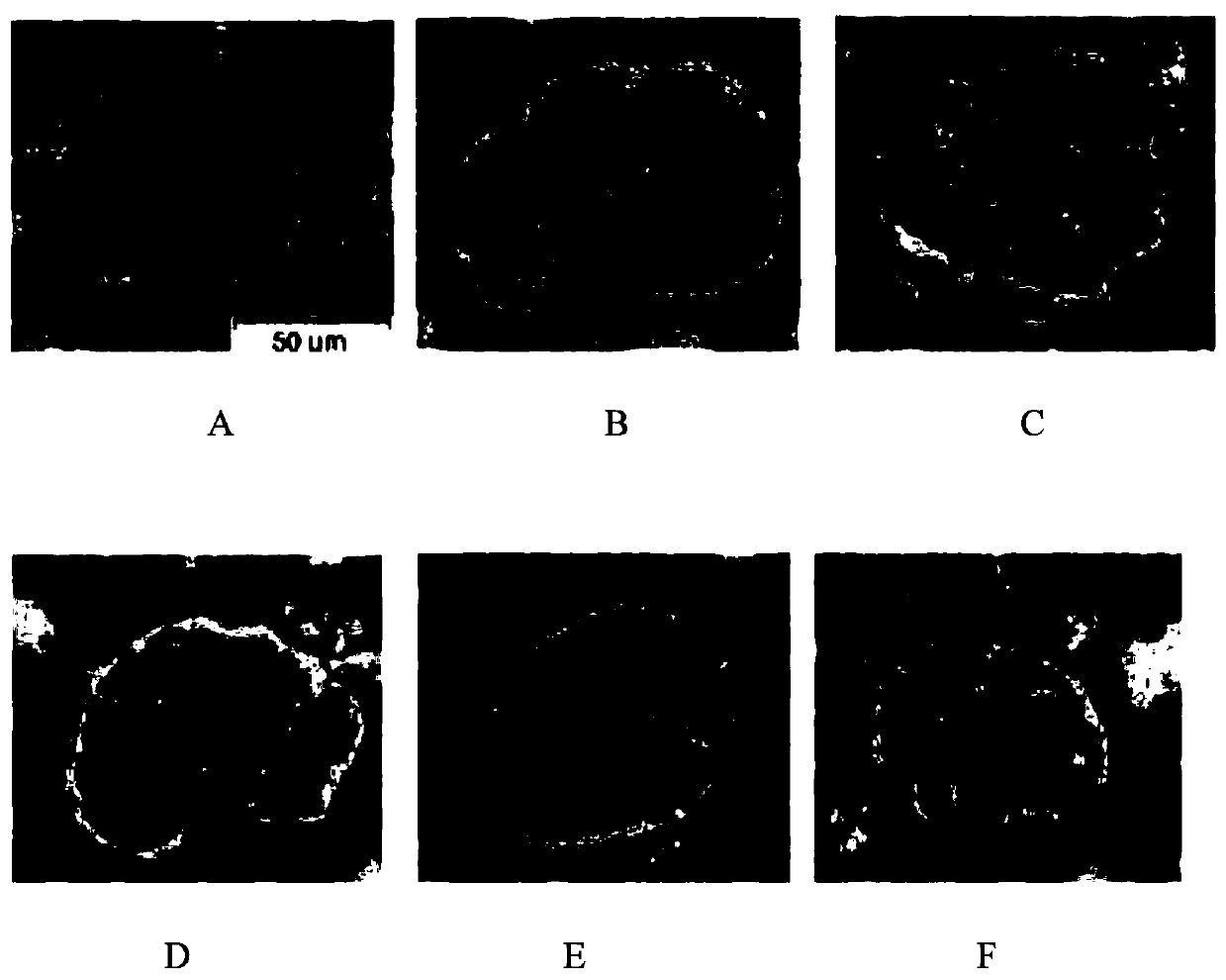 Bis-indolemaleimide derivative and preparation method and use thereof