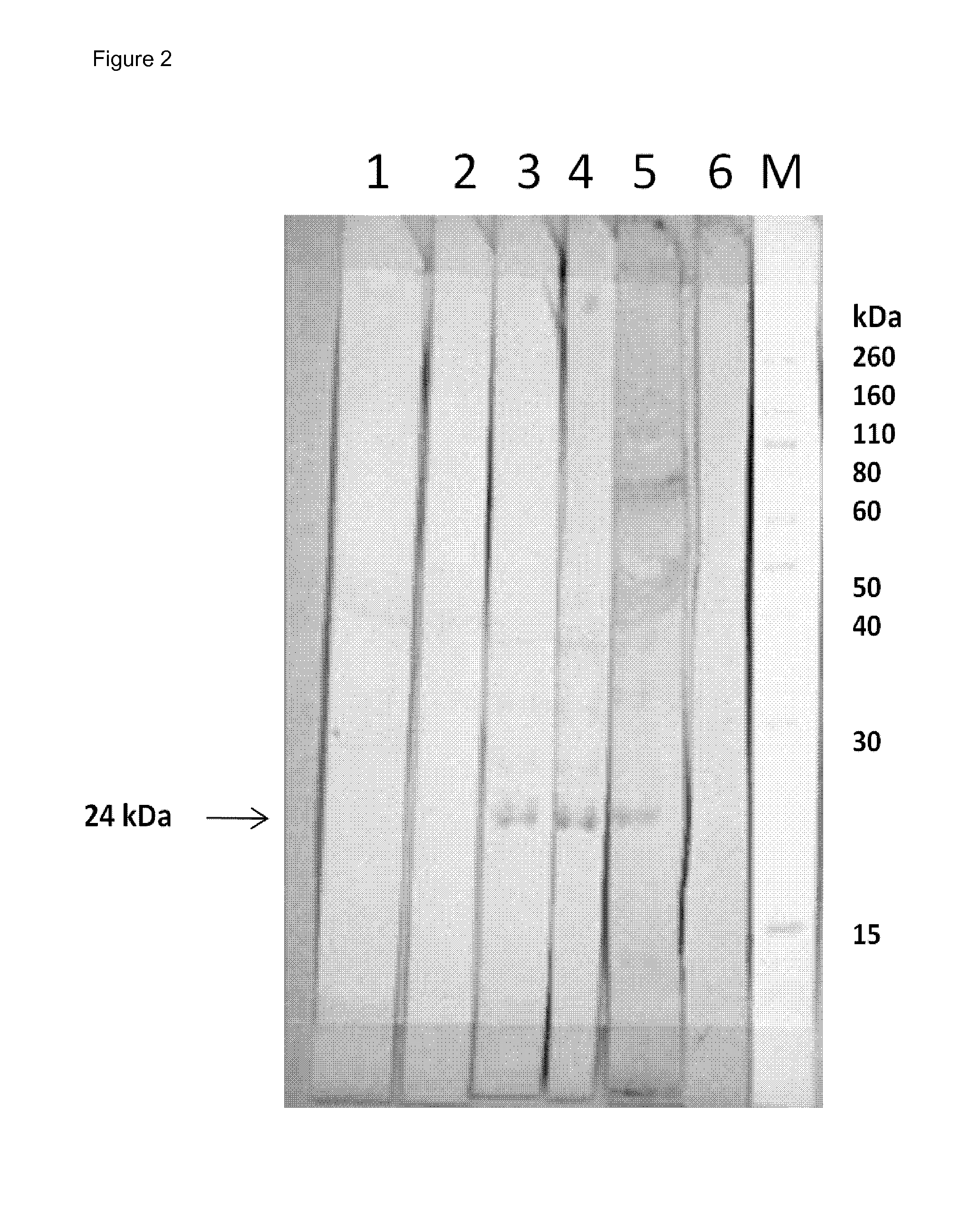 Neutralizing human monoclonal antibodies against hepatitis b virus surface antigen