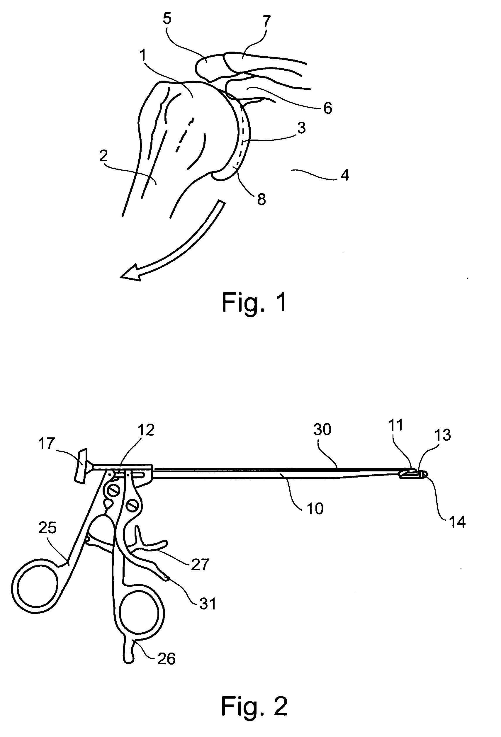 Surgical Instrument and Method for Attaching Soft Tissue to a Bone