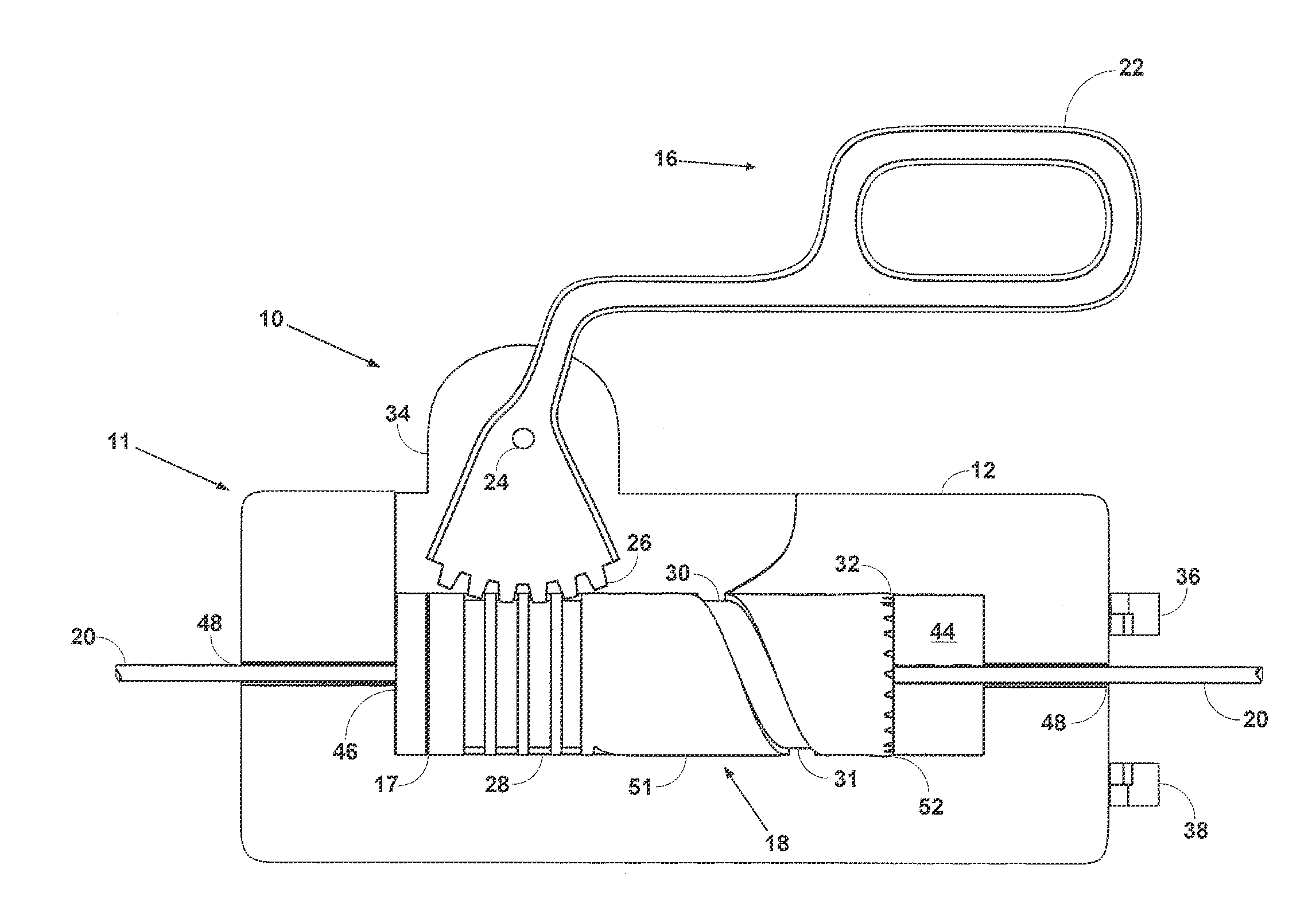 Torque For Incrementally Advancing a Catheter During Right Heart Catheterization