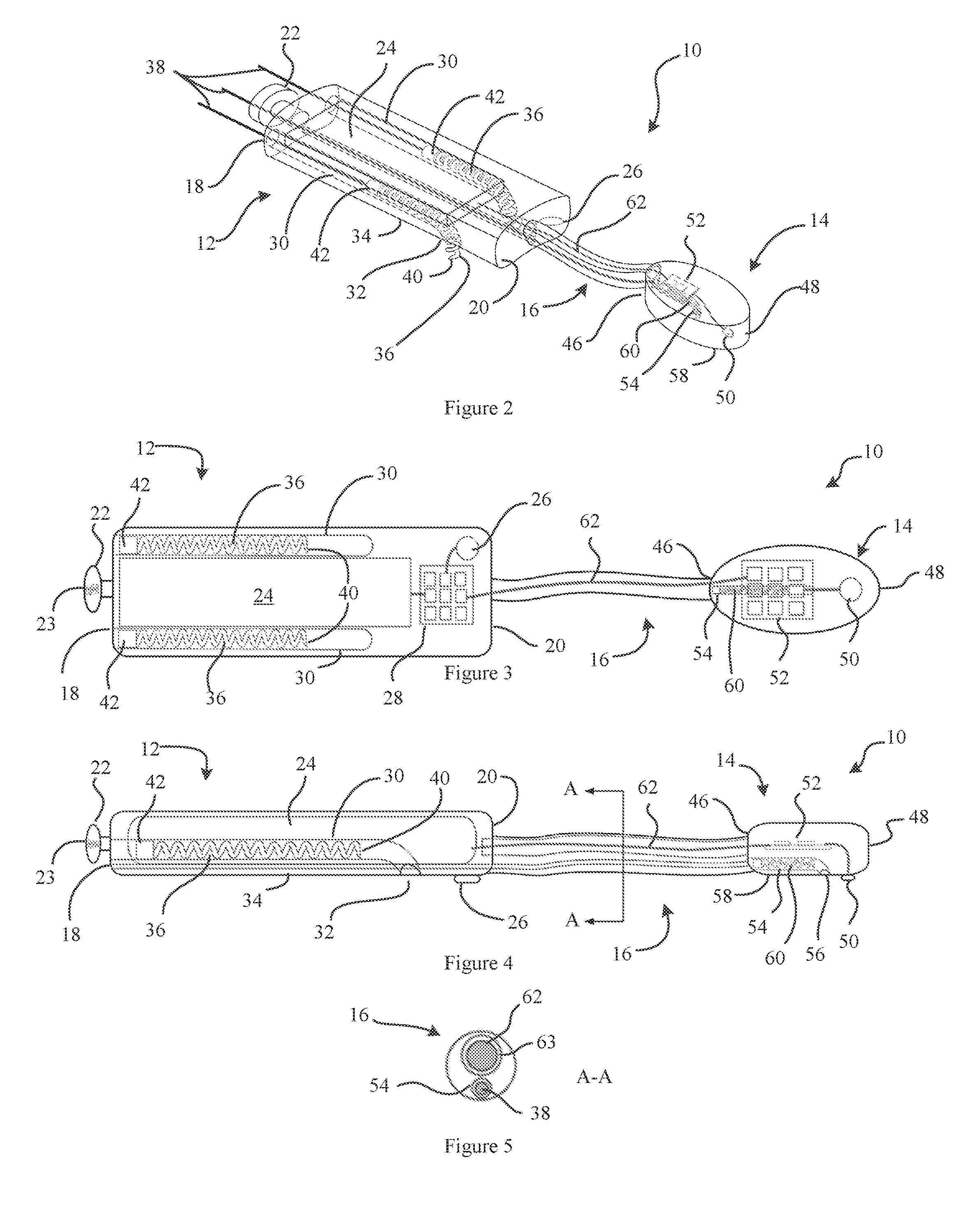 Epicardial Heart Rhythm Management Devices, Systems and Methods