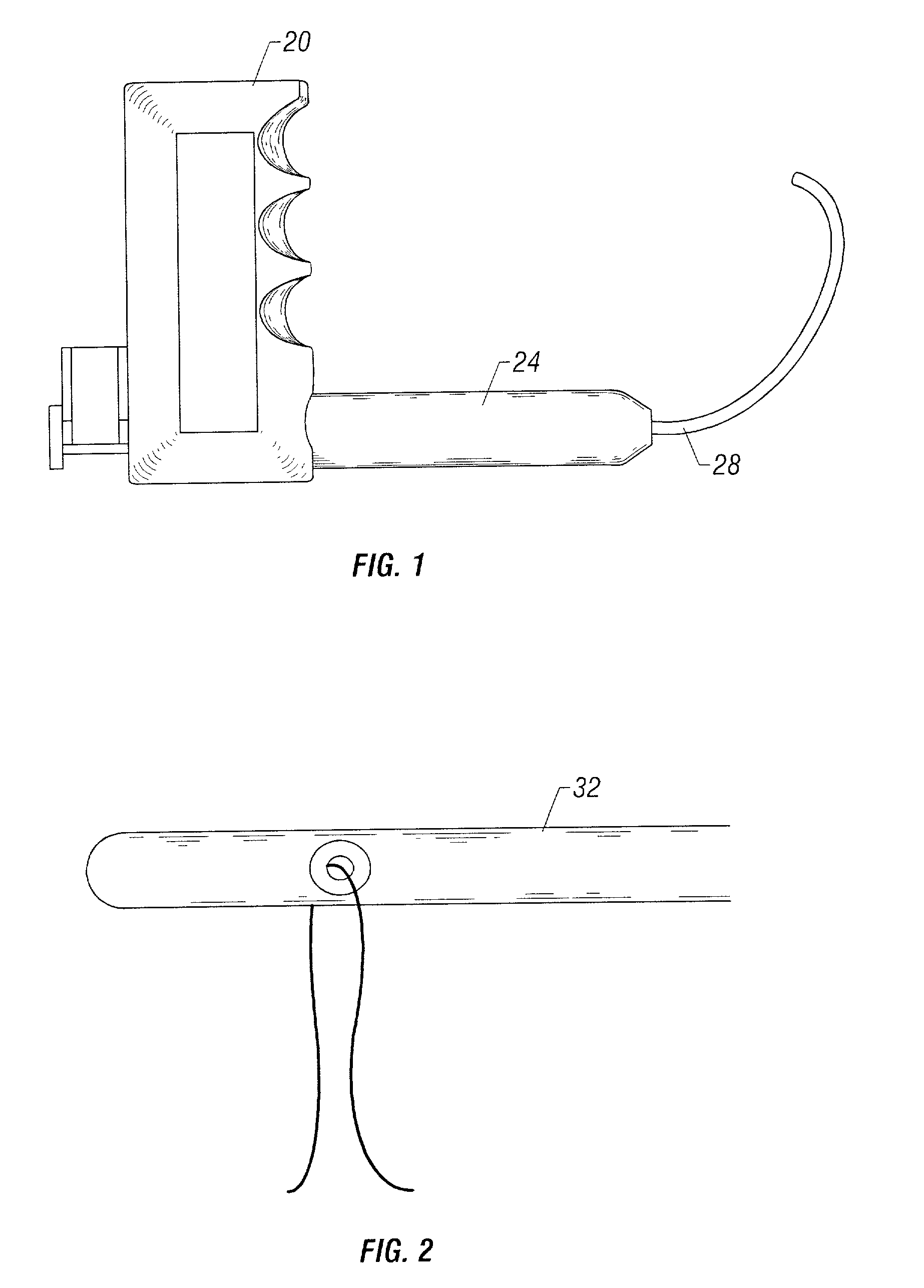 Method and apparatus for correction for gynecological pathologies including treatment of female cystocele