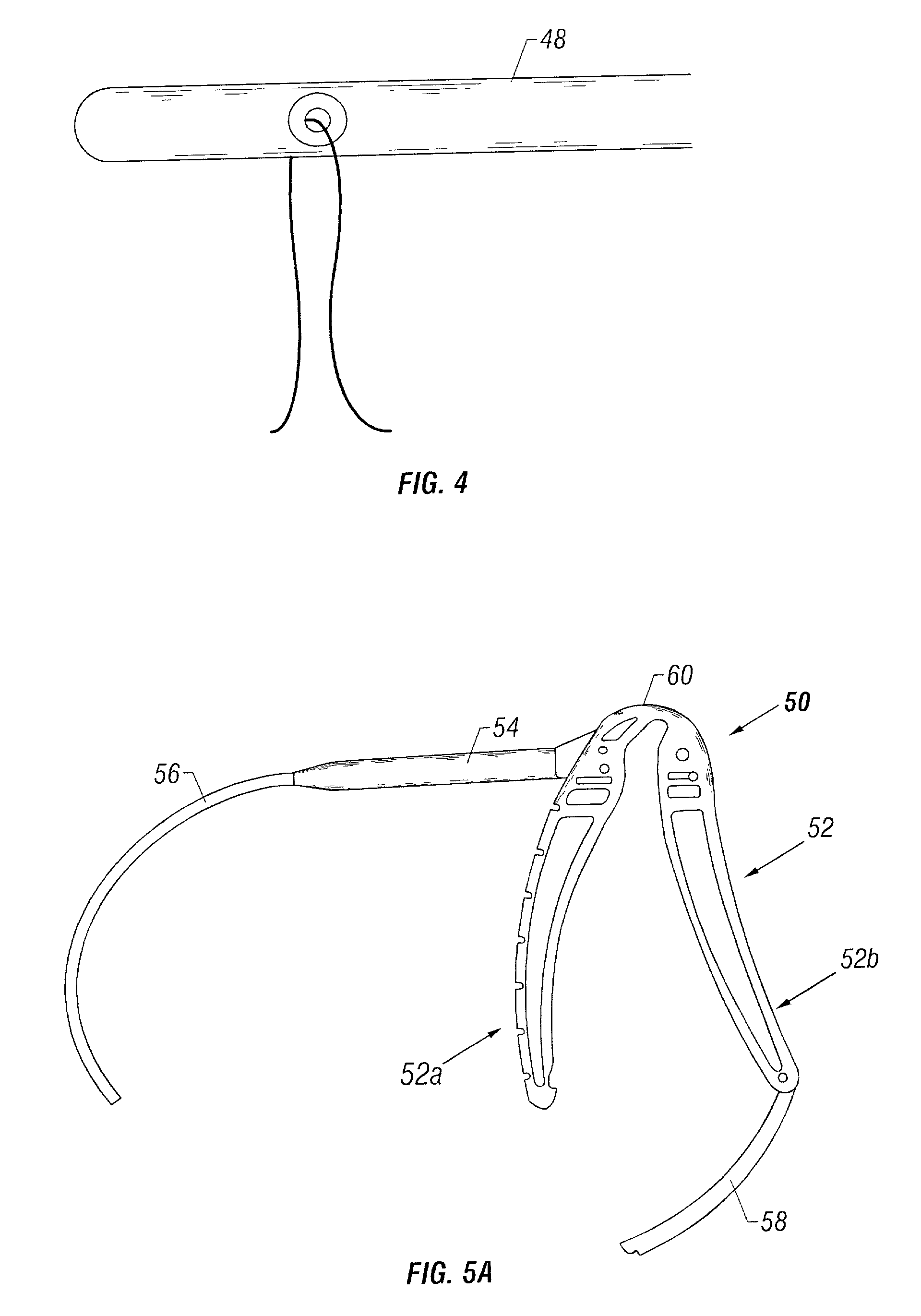 Method and apparatus for correction for gynecological pathologies including treatment of female cystocele