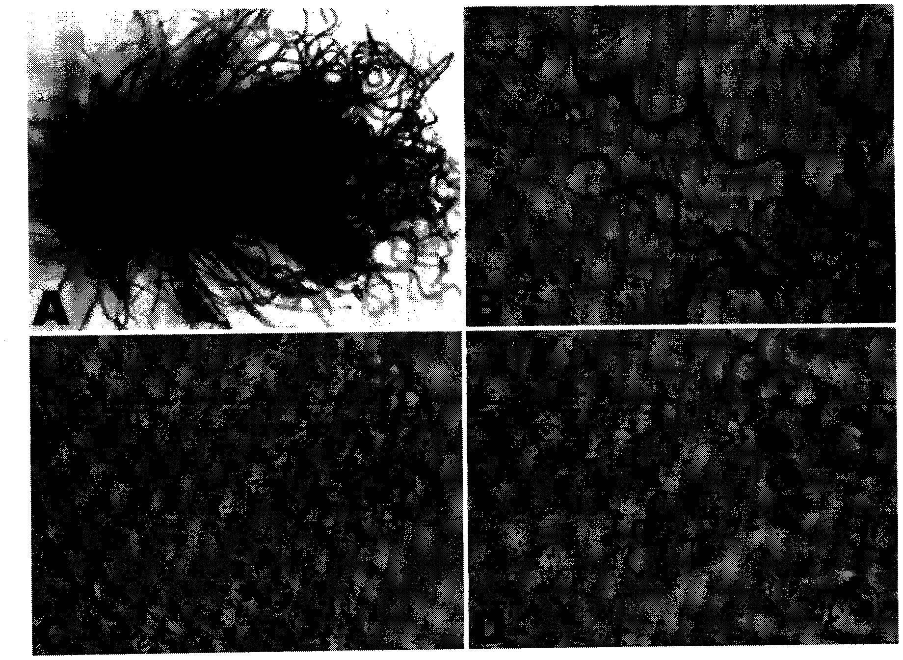 Endophytic fungi chaetomium globosum strain, microbial agent and application thereof