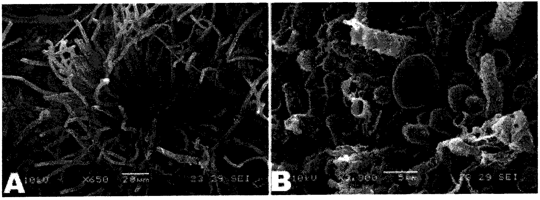 Endophytic fungi chaetomium globosum strain, microbial agent and application thereof