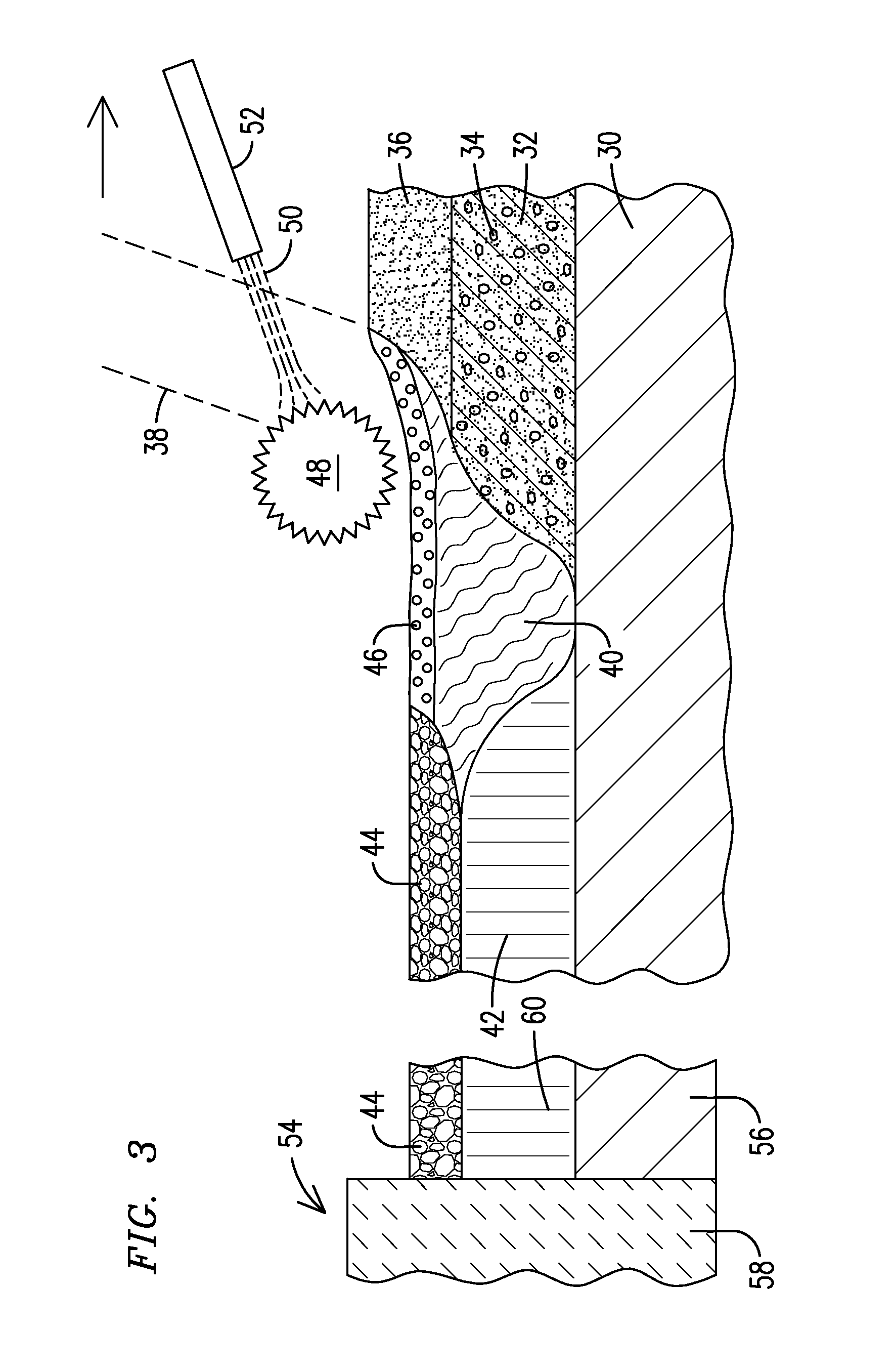 Laser metalworking of reflective metals using flux