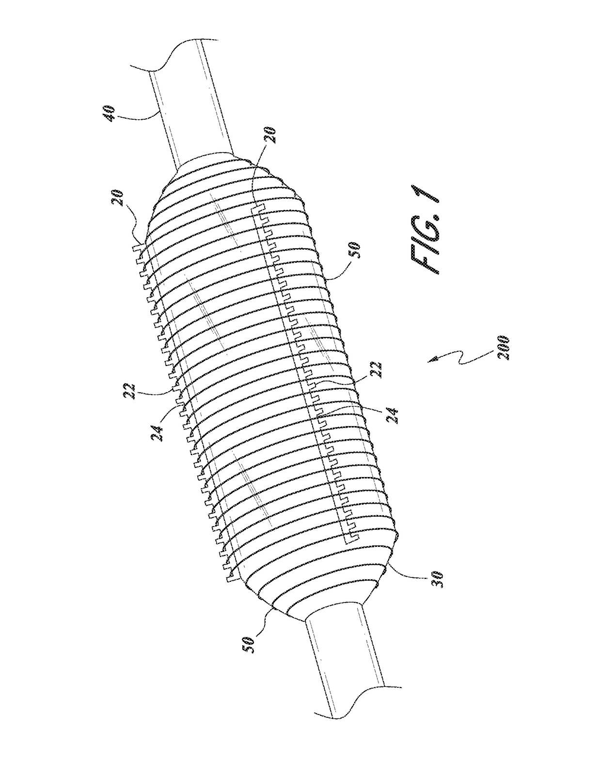 Serration balloon