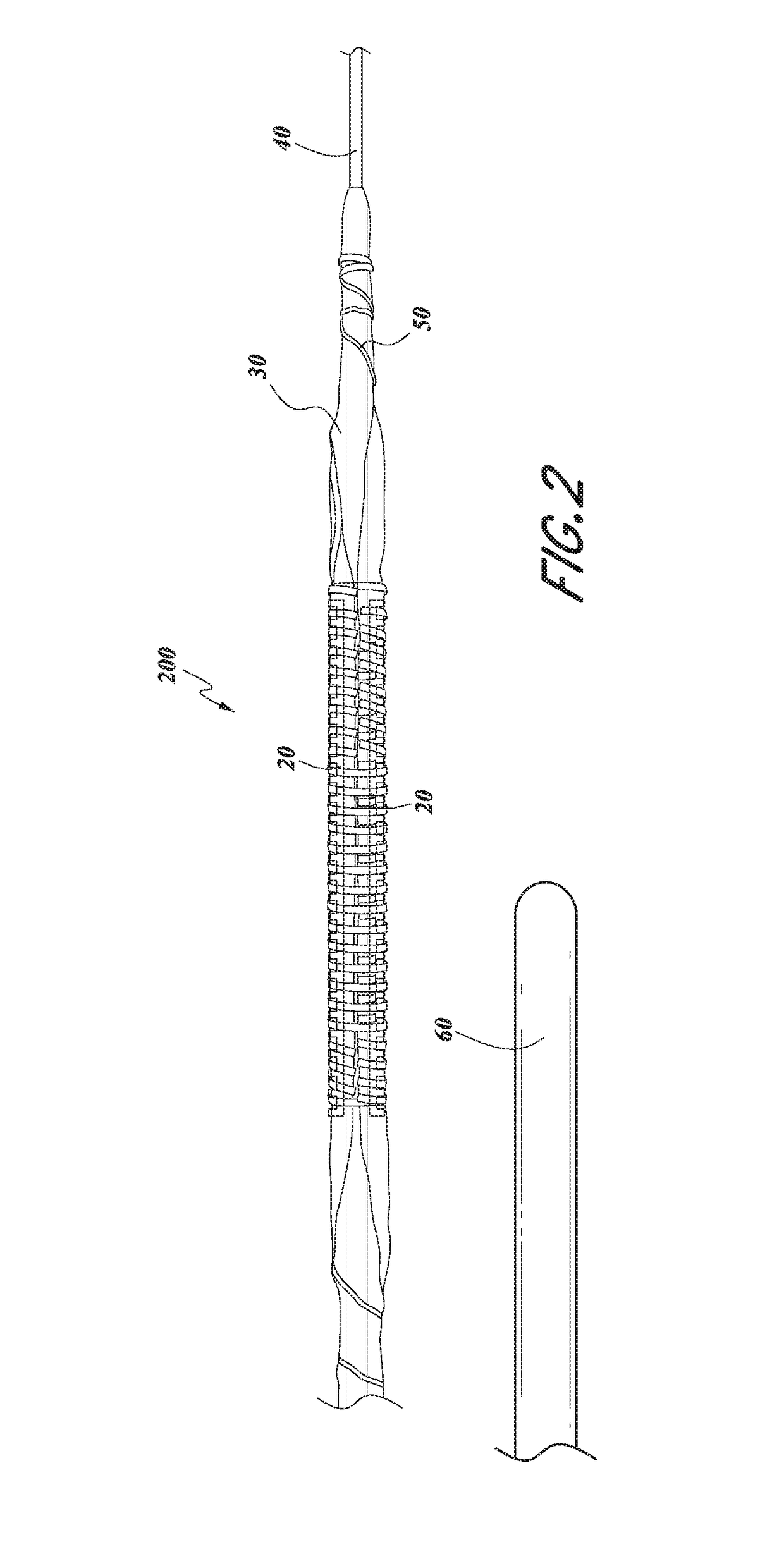 Serration balloon