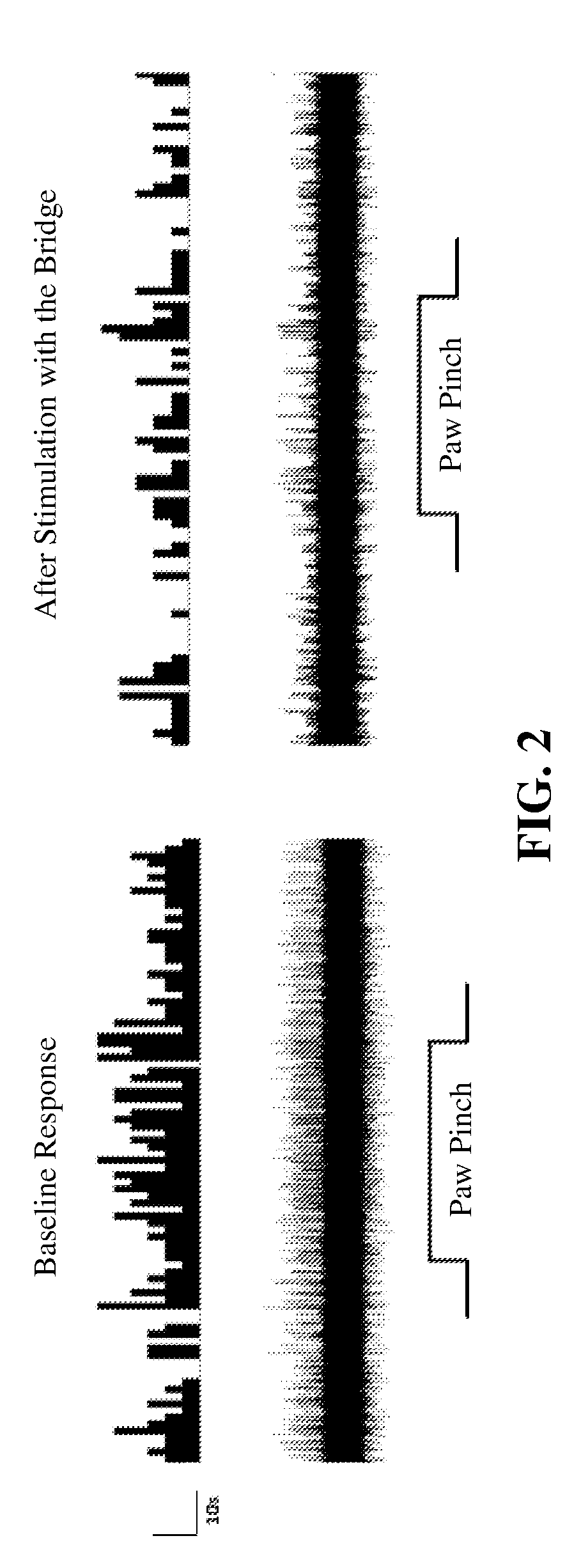 Methods of treating disease using auricular peripheral nerve field stimulation