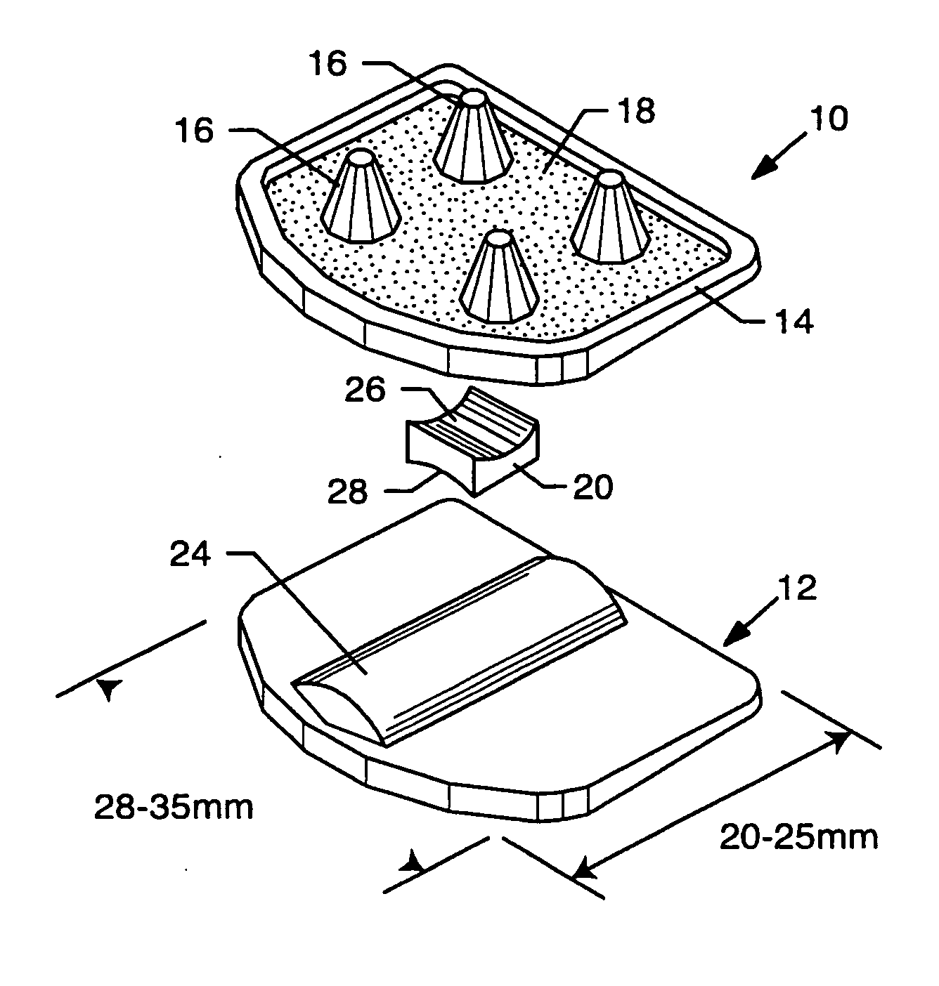 Total disc implant