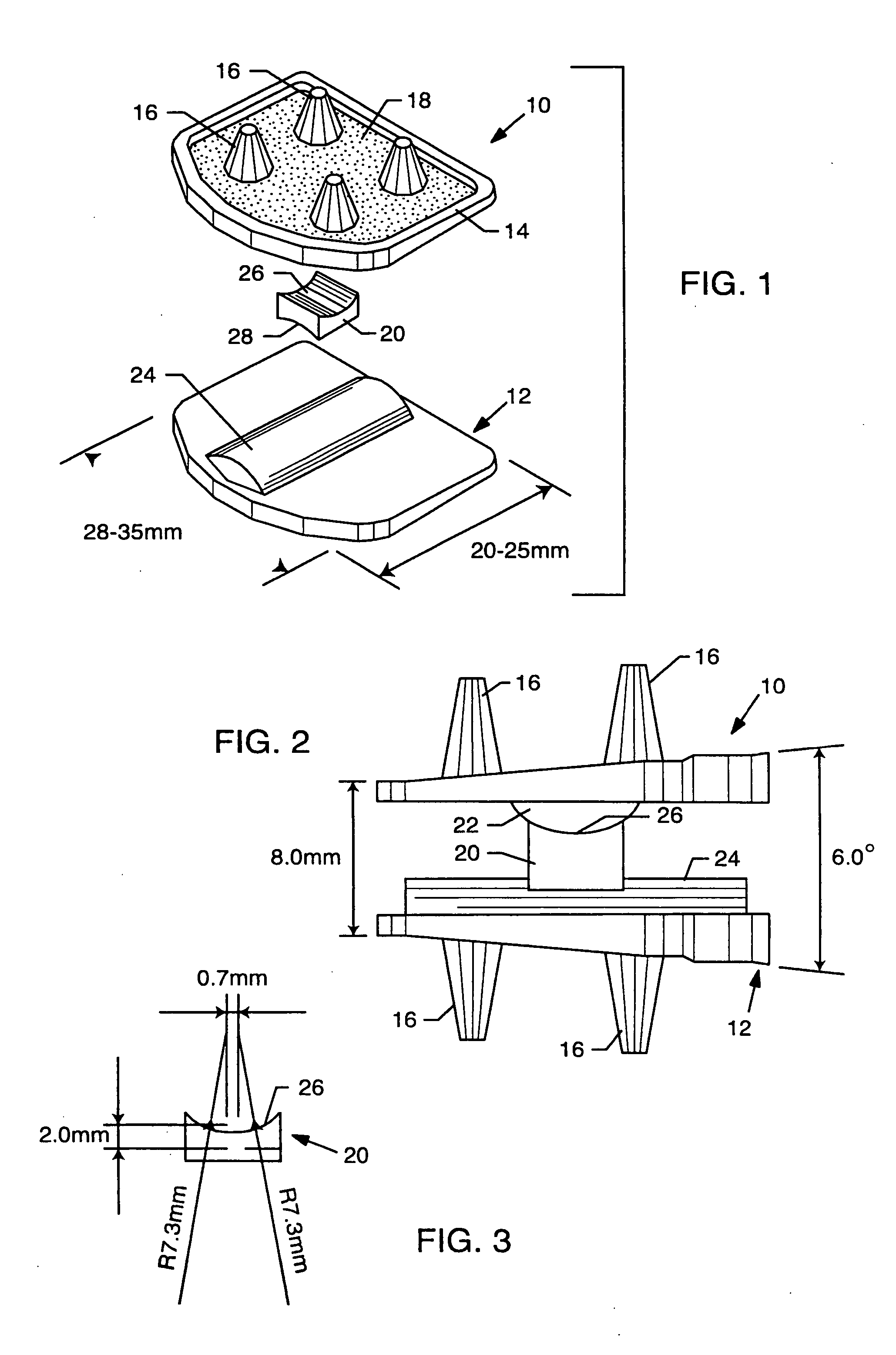 Total disc implant