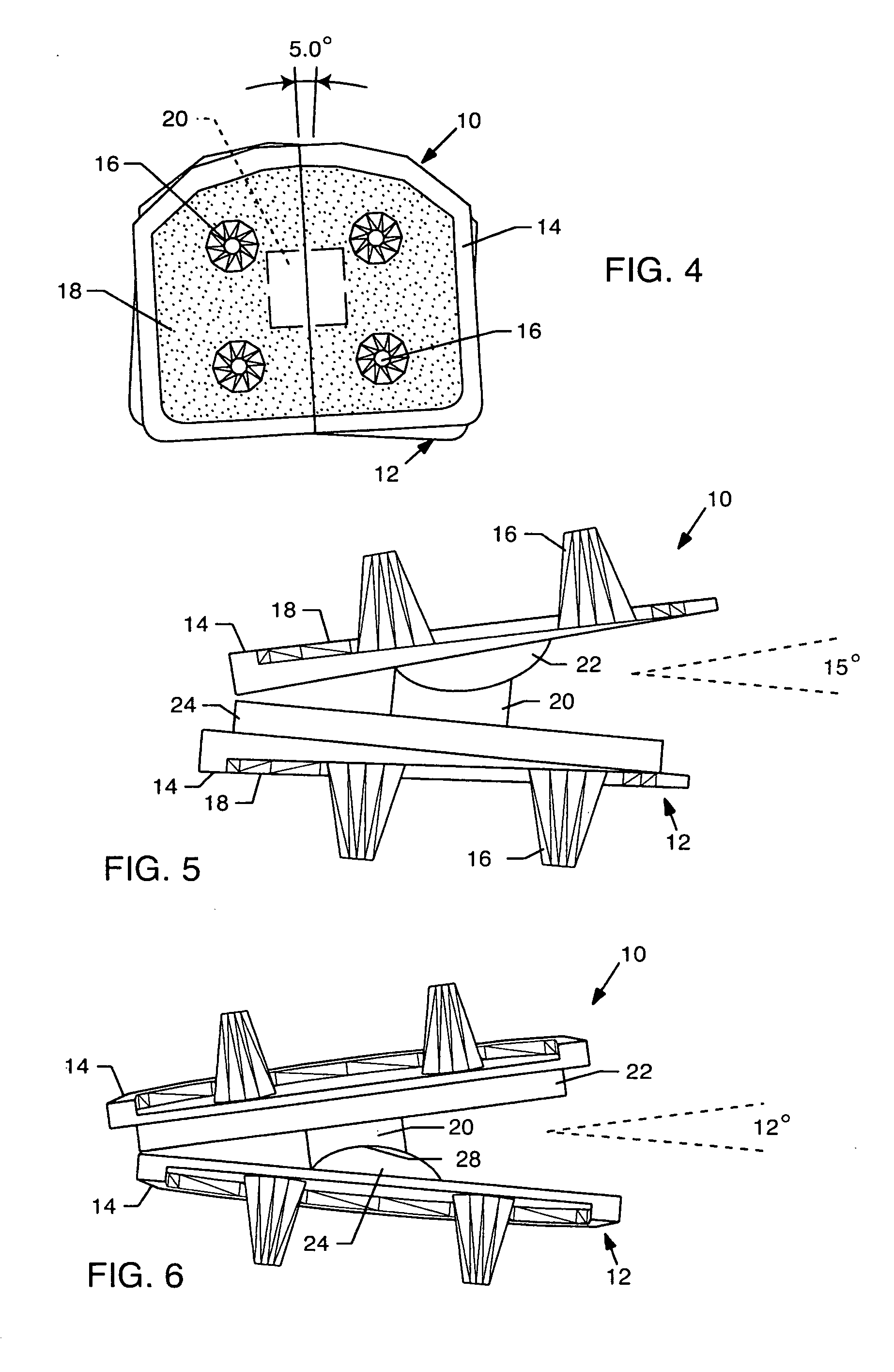 Total disc implant