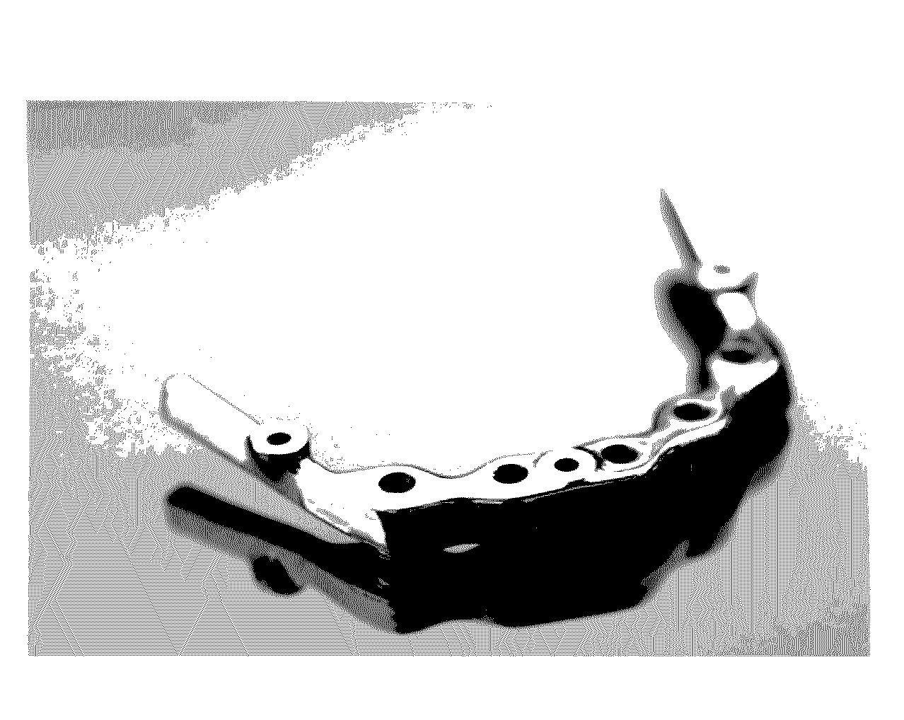 Sequential dental surgical guide system and related methods