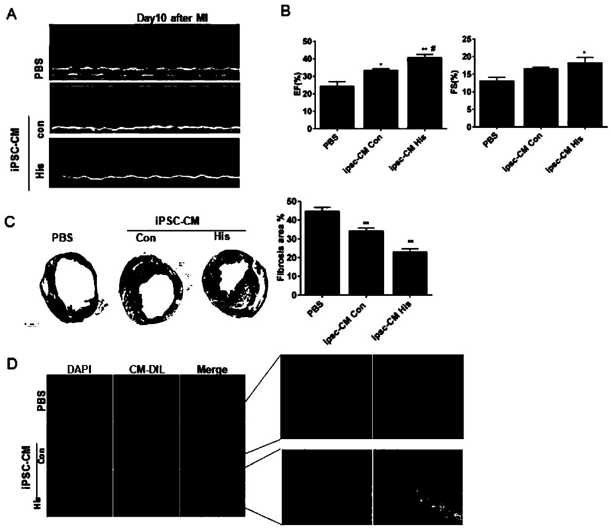 Method for inducing differentiation of multipotent stem cells into myocardial cells by biogenic amine and application