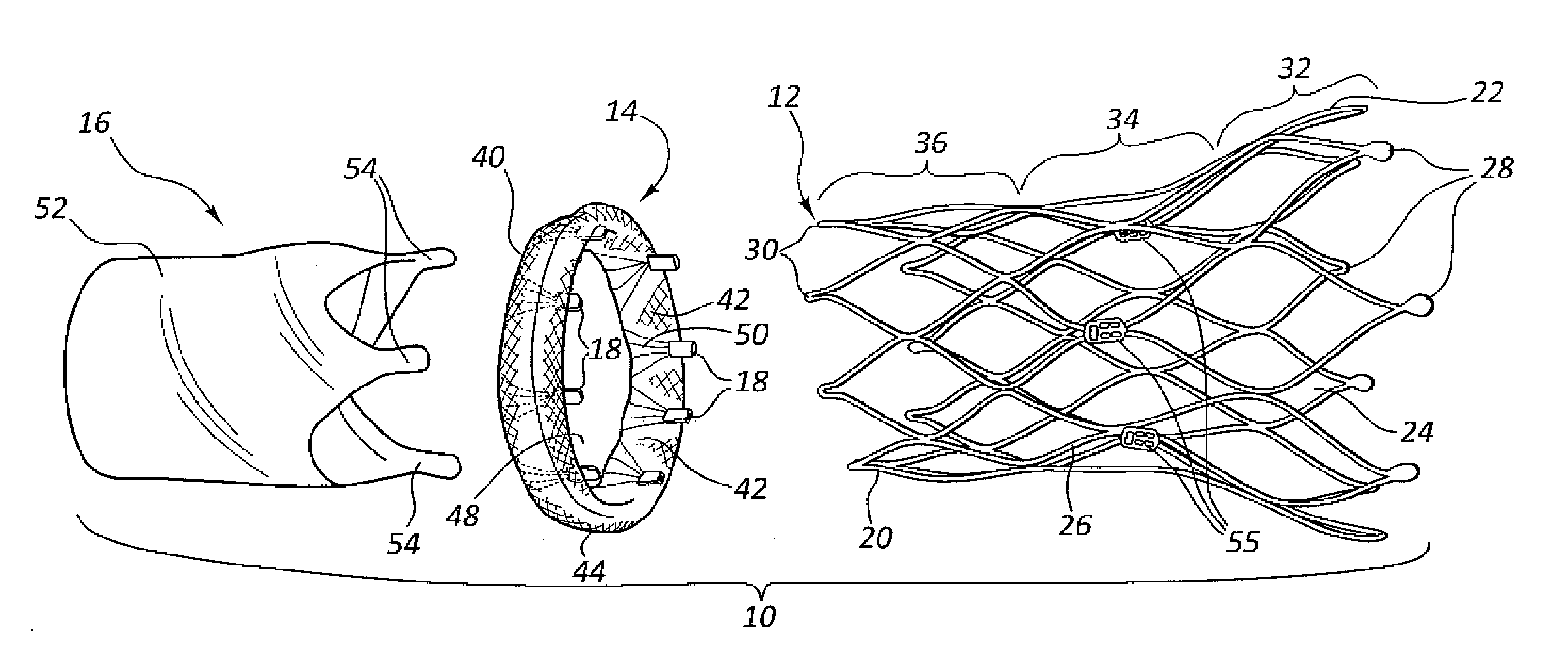 Collapsible valve having paravalvular leak protection