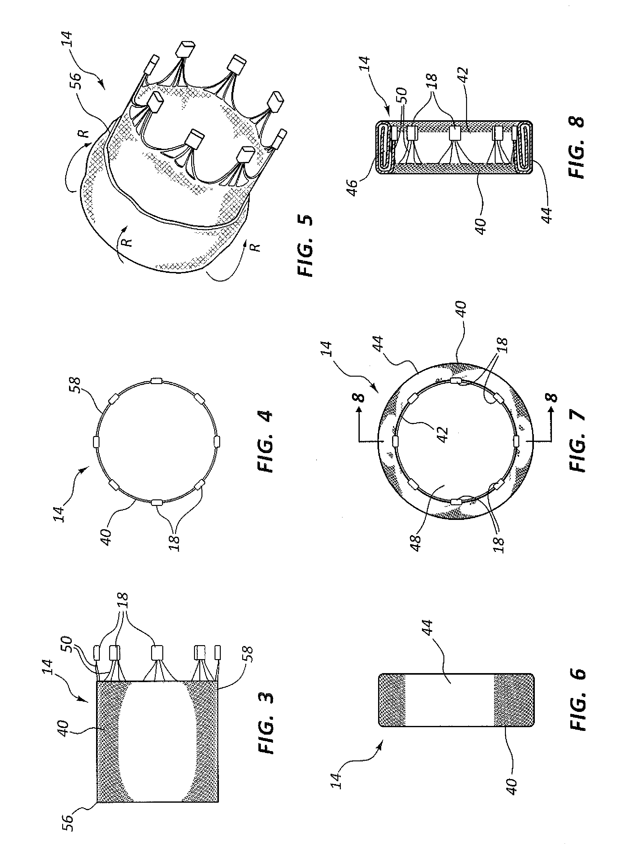 Collapsible valve having paravalvular leak protection