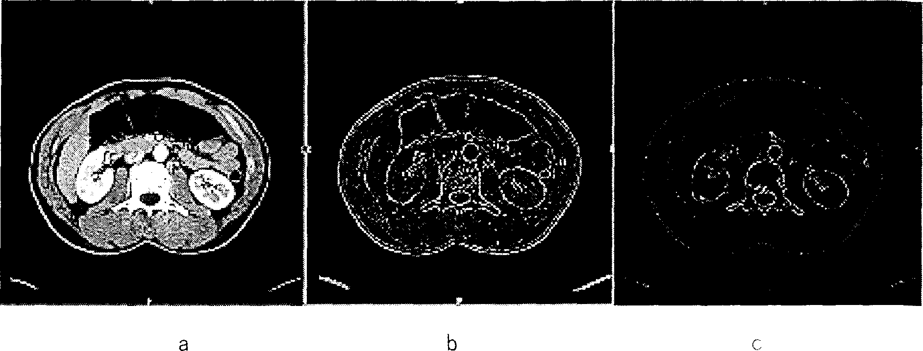 Three-dimensional dividing method for medical images