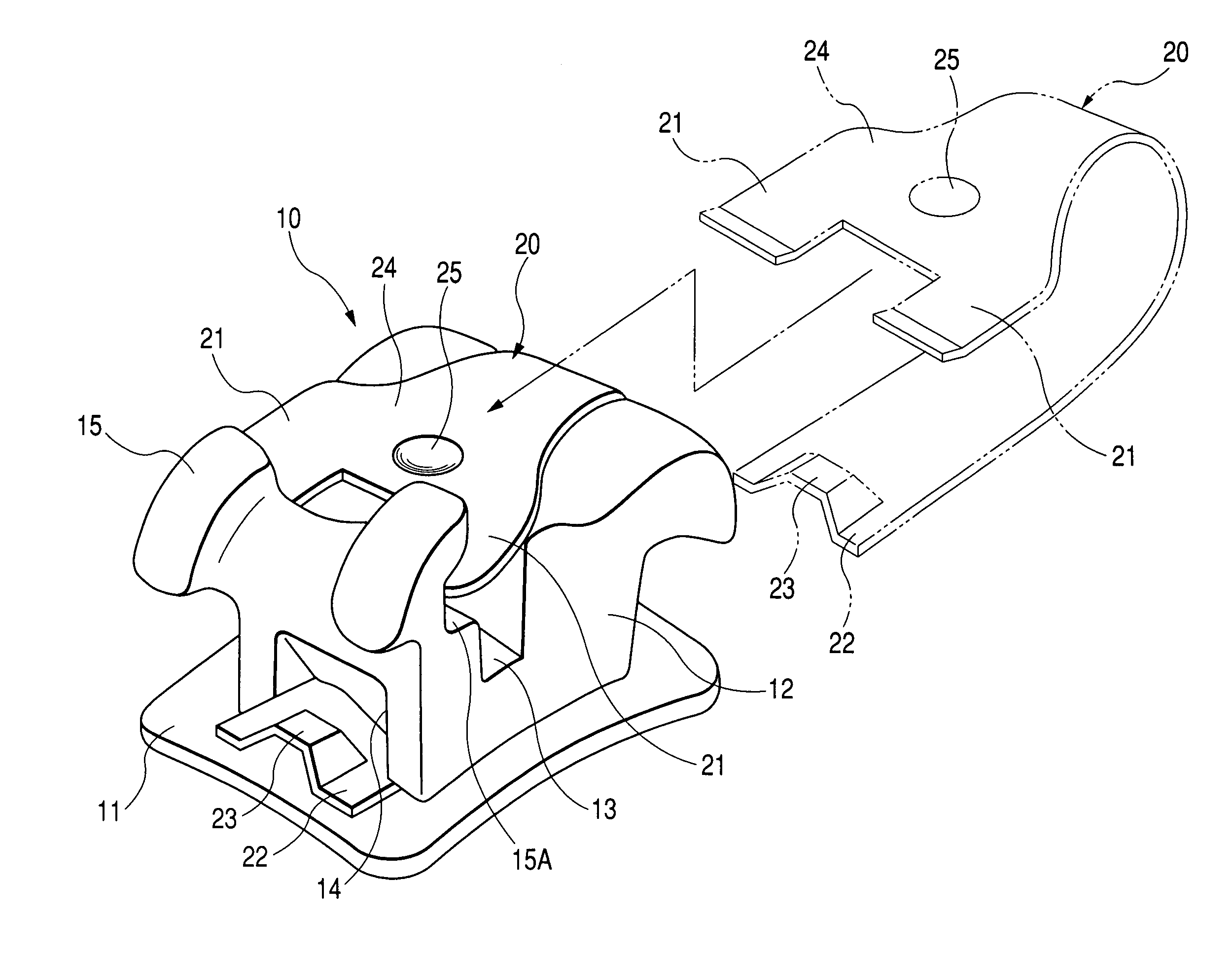 Orthodontic bracket and clip release tool