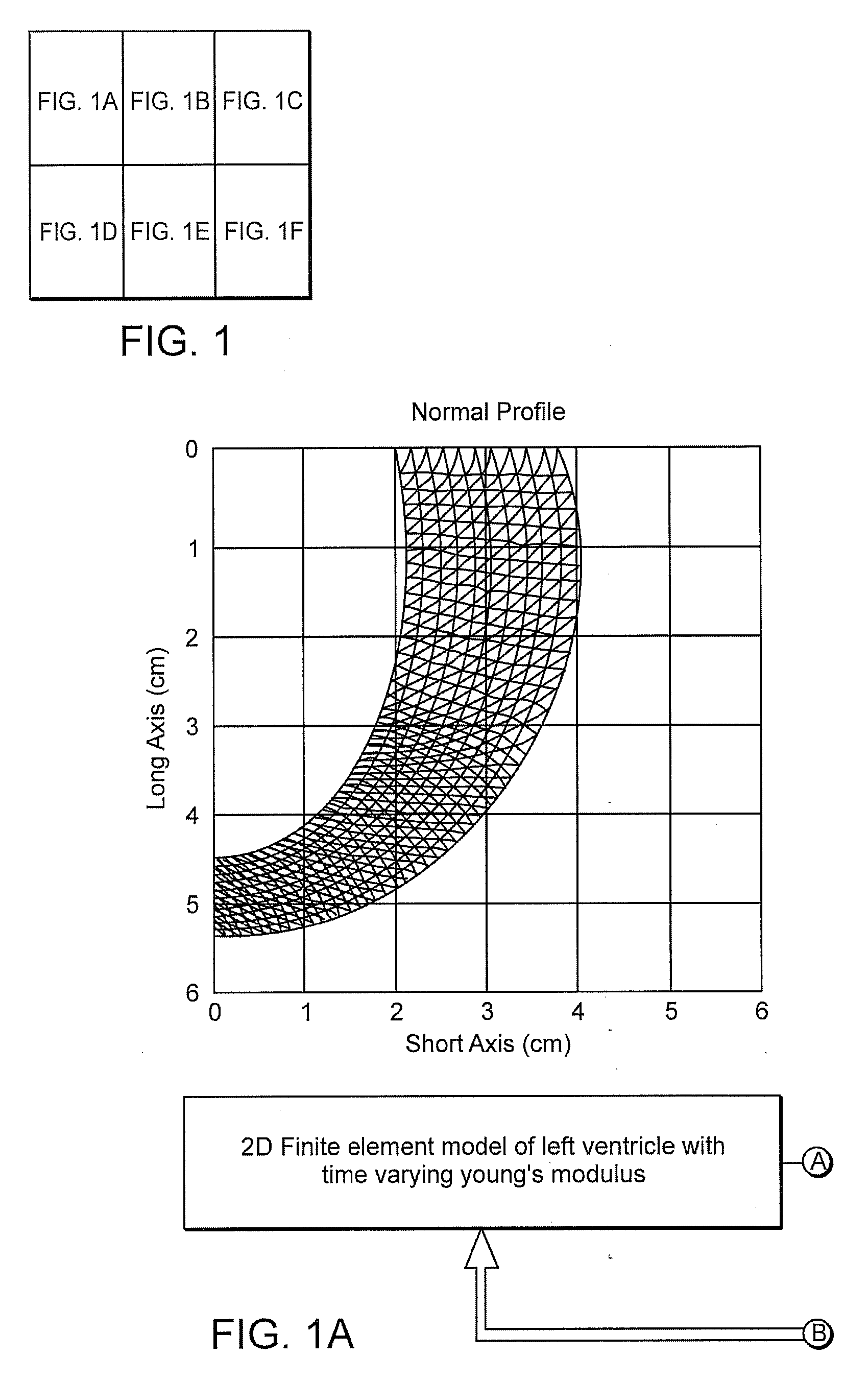 Integrated finite element and circulatory model for predicting hemodynamic effects of left ventricular impairment, resynchronization and remodeling