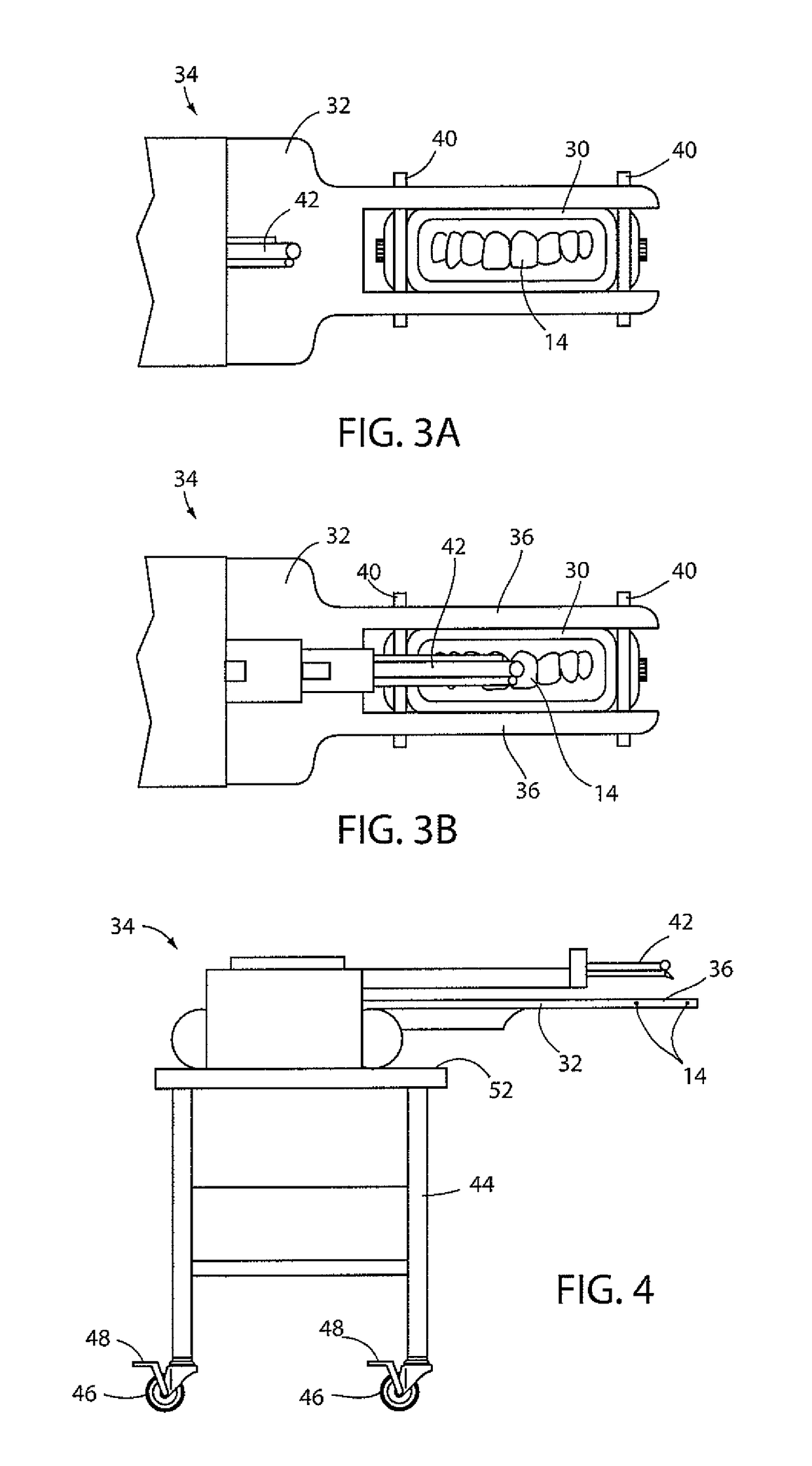 In-situ dental restoration process and apparatus