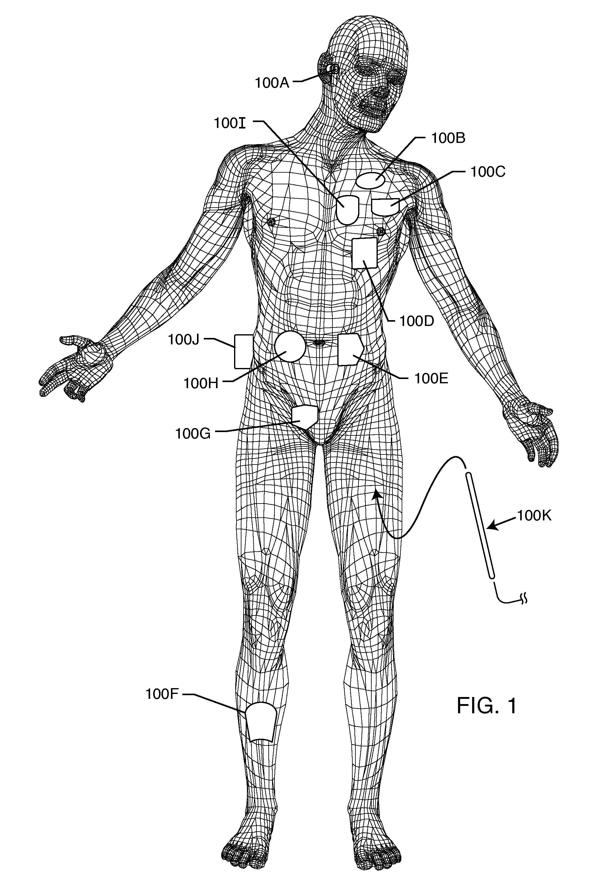 Frequency selective passive component networks for active implantable medical devices utilizing an energy dissipating surface