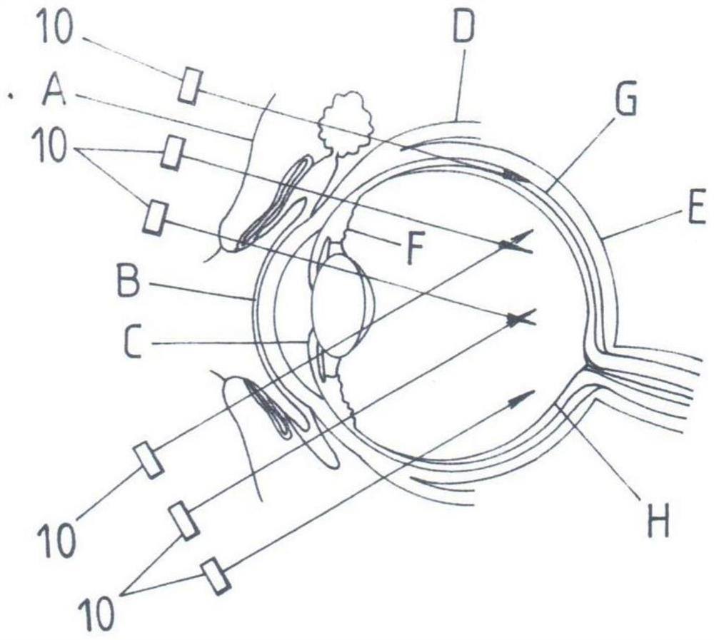 Myopia-preventing lighting device for lighting eyeballs and peripheral tissues of eyeballs