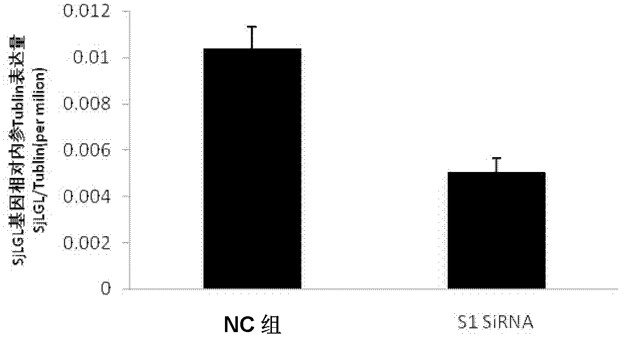 SiRNA of SjLGL gene of schistosoma japonica and use thereof