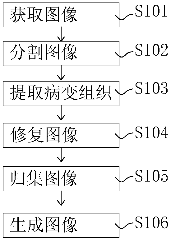 Lesion image generation method, device and computer-readable storage medium