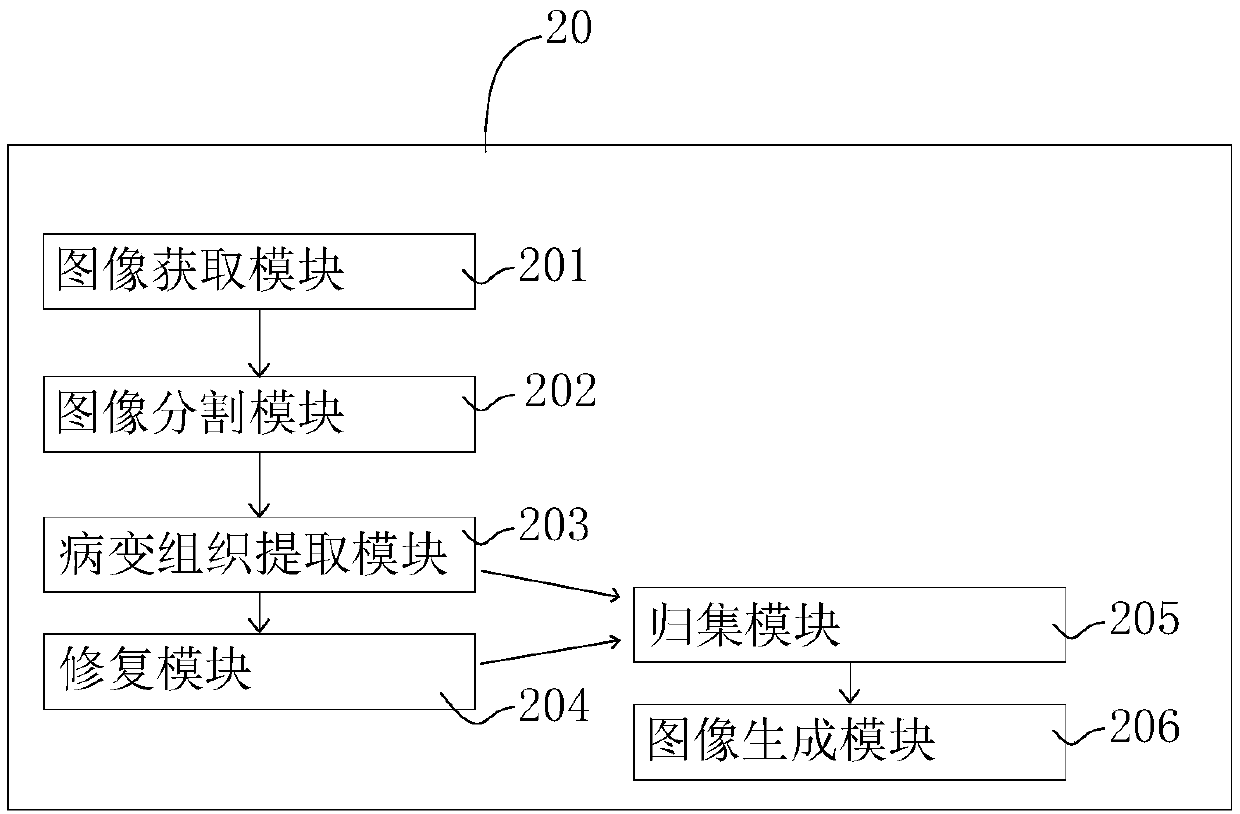 Lesion image generation method, device and computer-readable storage medium