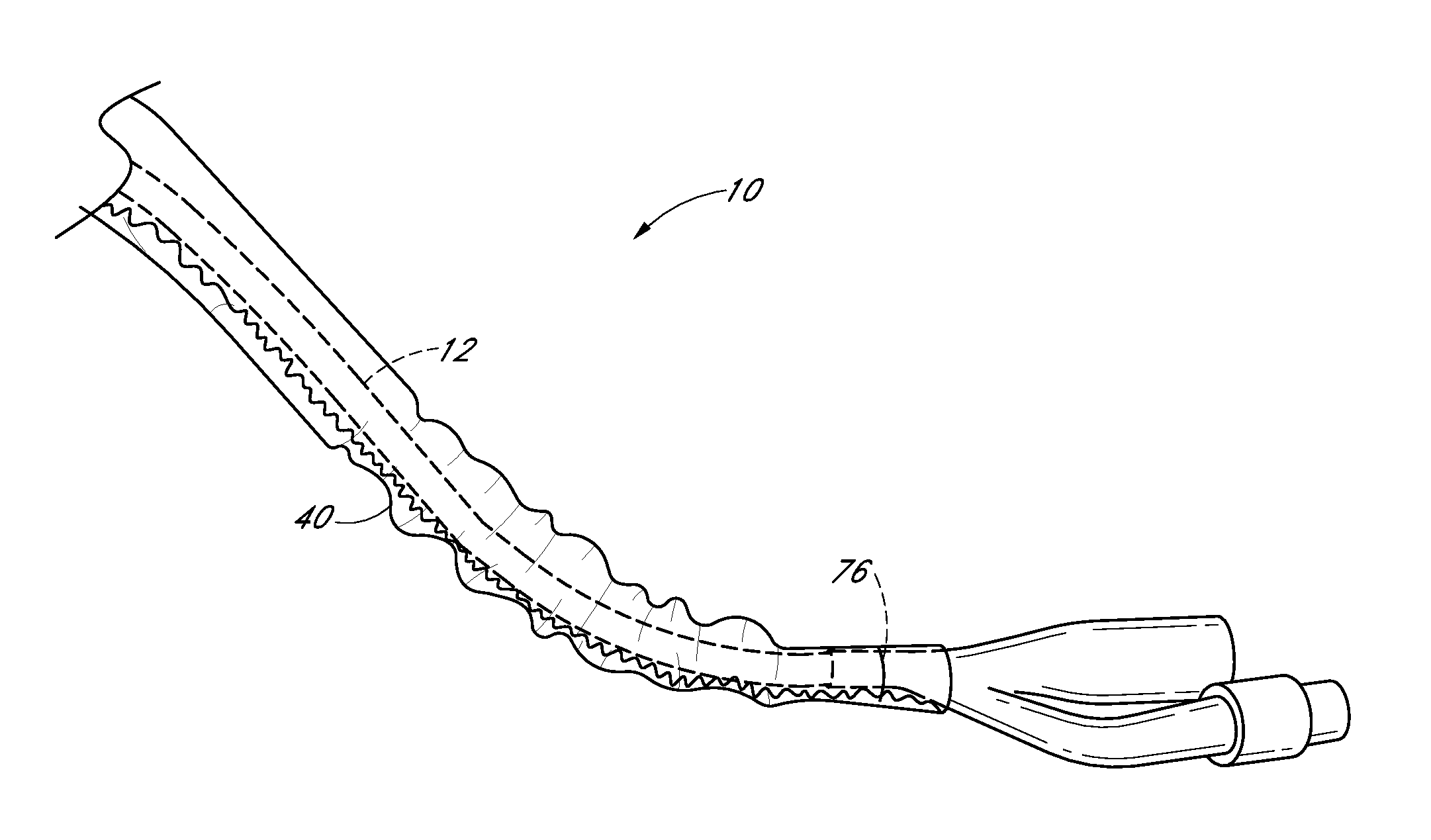 Foley catheter having sterile barrier