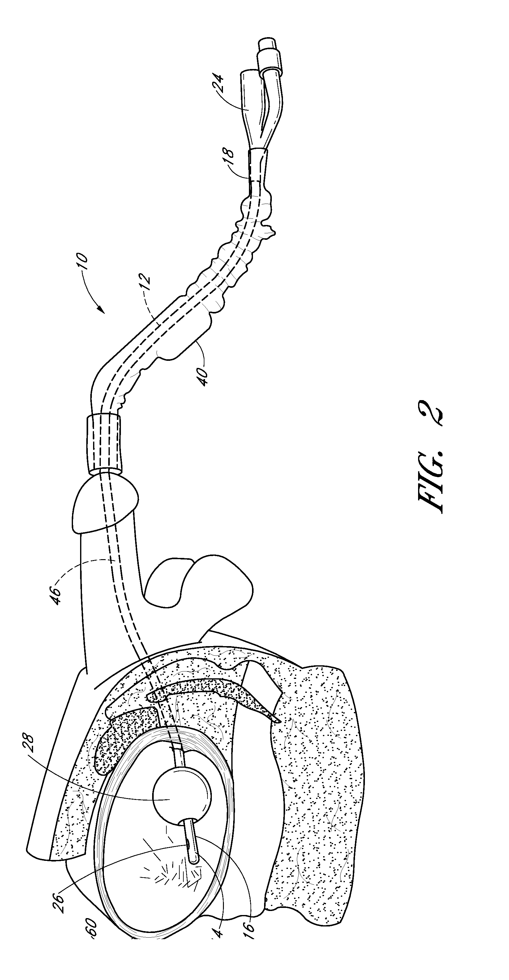 Foley catheter having sterile barrier