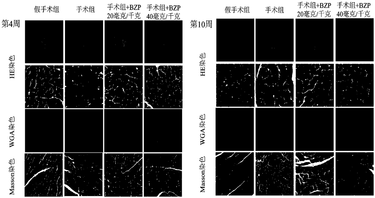 Drug use of 5-bromo-2-(alpha-hydroxypentyl) sodium benzoate in treatment of cardiac hypertrophy and heart failure