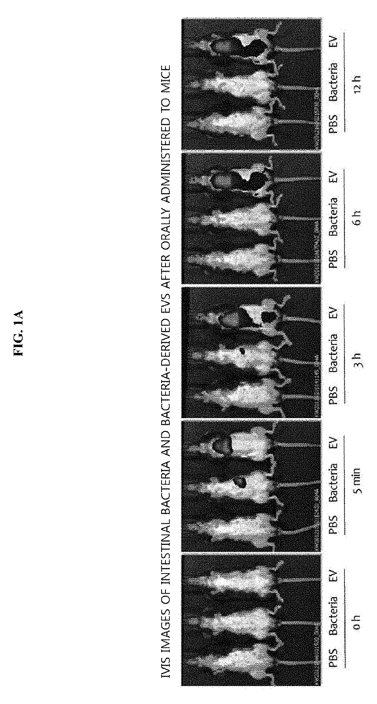 Method for diagnosing colon tumor via bacterial metagenomic analysis