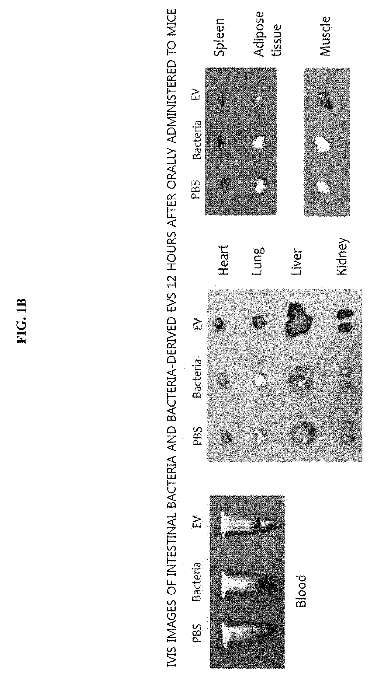 Method for diagnosing colon tumor via bacterial metagenomic analysis