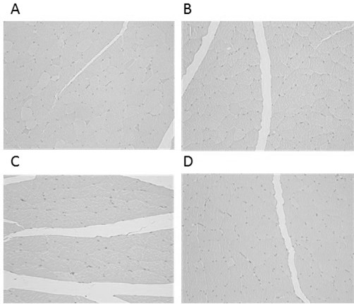 A kind of tediroxin suspension injection and preparation method thereof