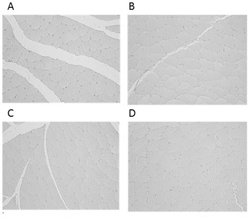 A kind of tediroxin suspension injection and preparation method thereof