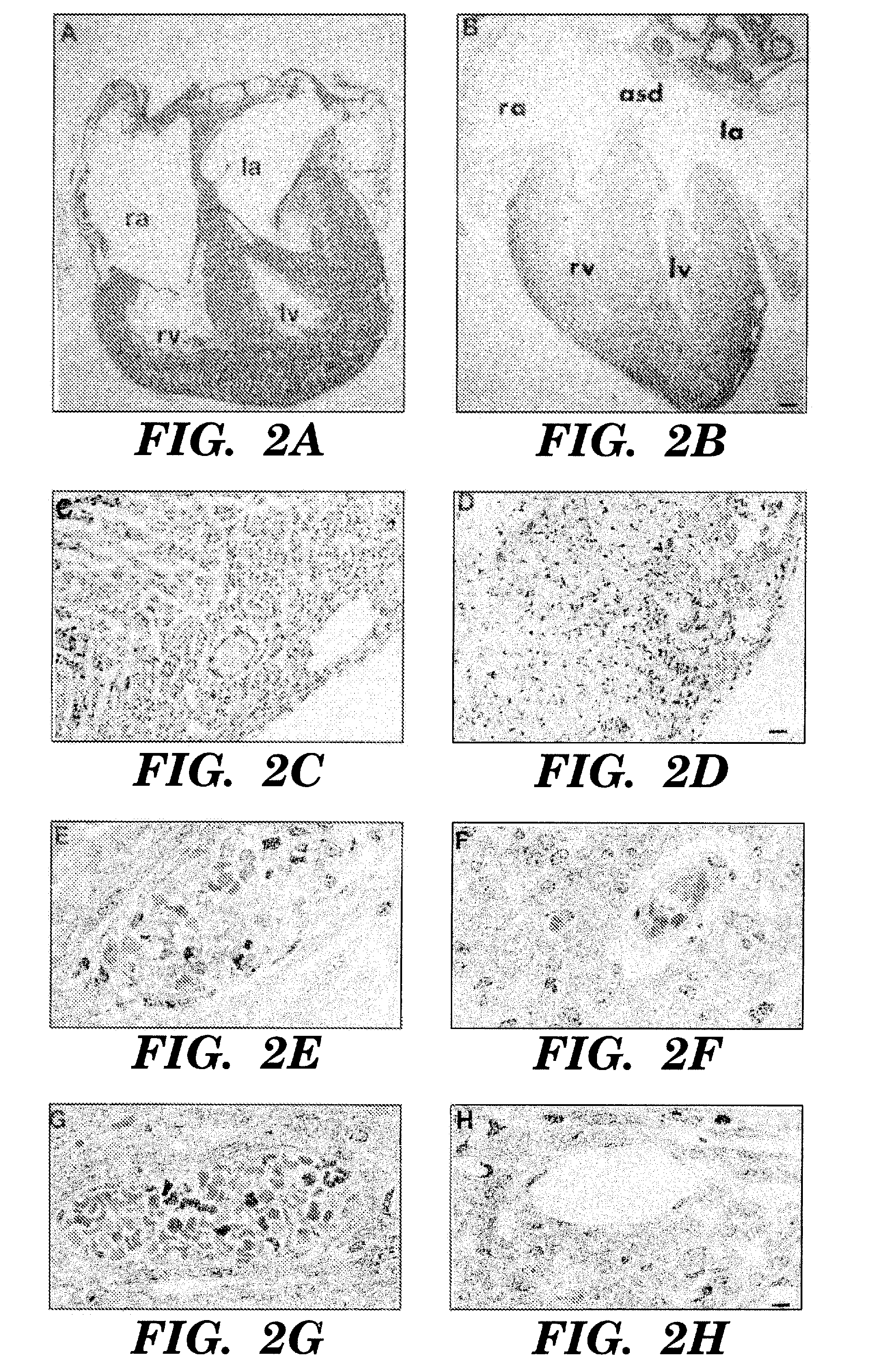 Methods for regulating angiogenesis and vascular integrity using trk receptor ligands