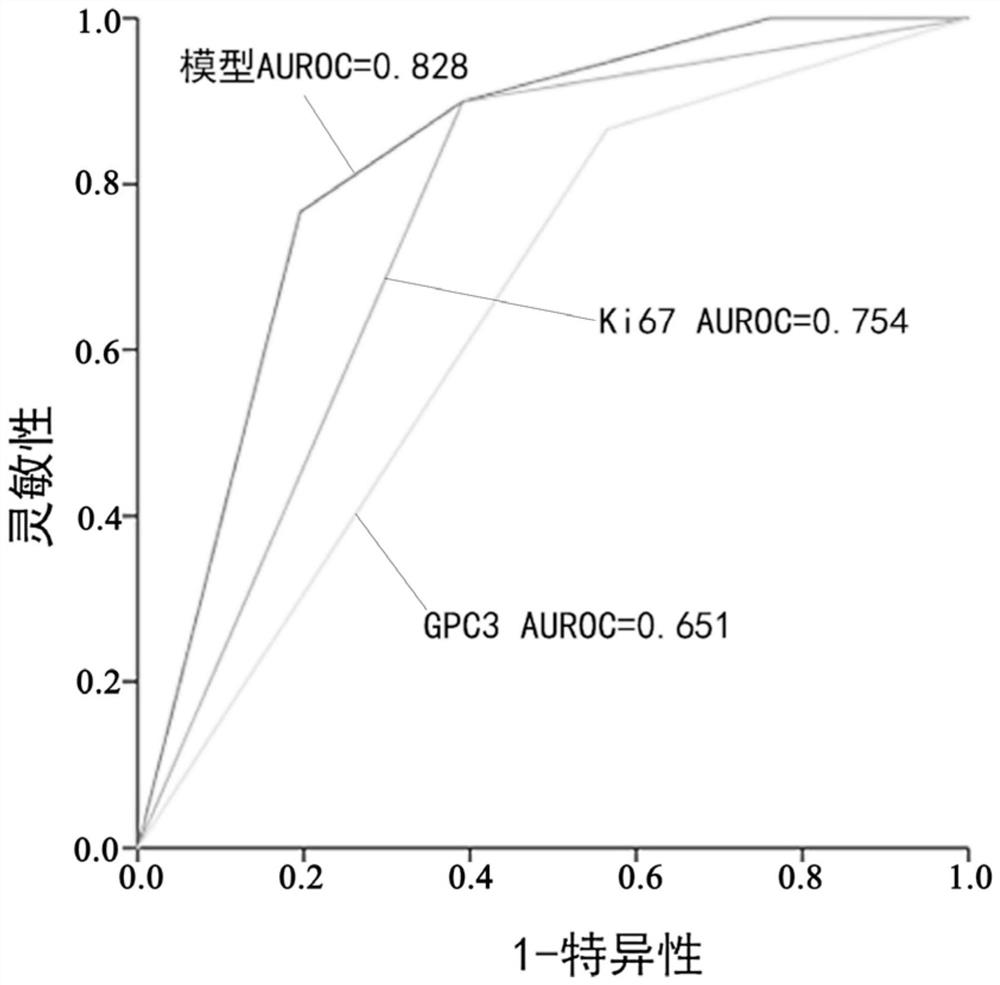 A method for constructing a PDX model of hepatocellular carcinoma