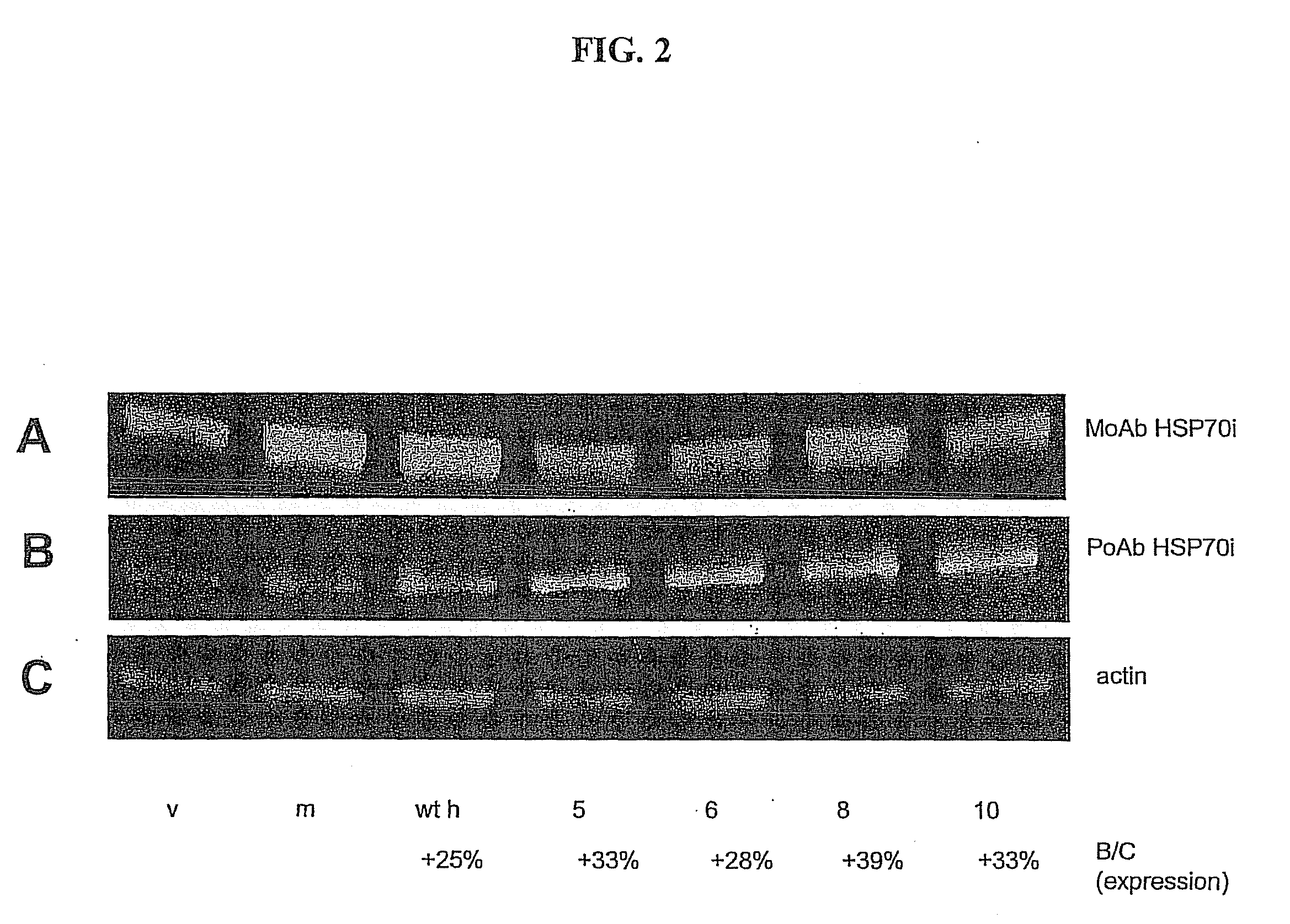 HSP70-Based Treatment for Autoimmune Diseases and Cancer