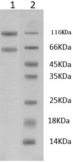 IL-2 receptor complex and its preparation method and application